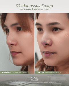 BF-AT คุณเมย์_มุม 45 องศา_ด้านซ้าย