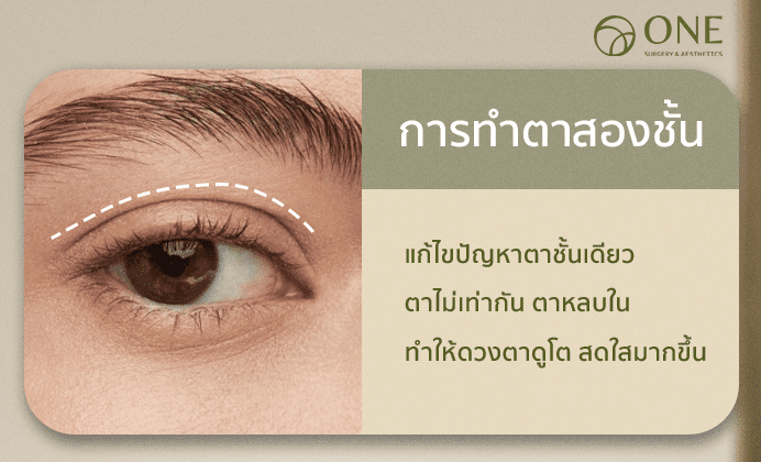 ศัลยกรรมตาสองชัั้น