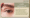 Sub-brow Lift