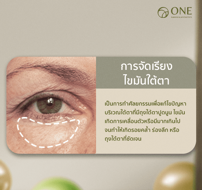 ผ่าตัดถุงใต้ตา