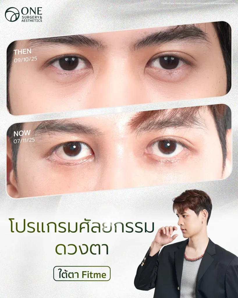 ศัลยกรรมตา