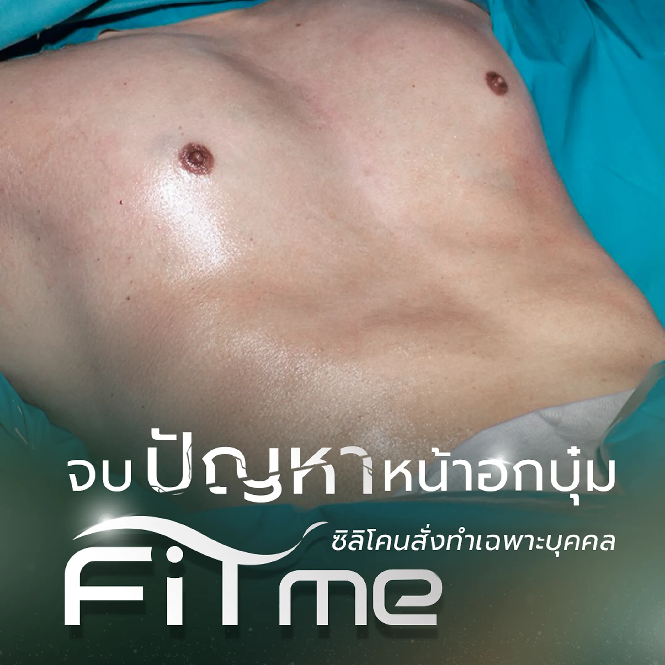 เสริมกล้ามอก