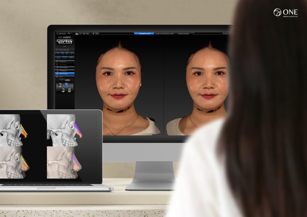 Vectra 3D Imaging Design