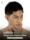 เสริมจมูกโอเพ่น