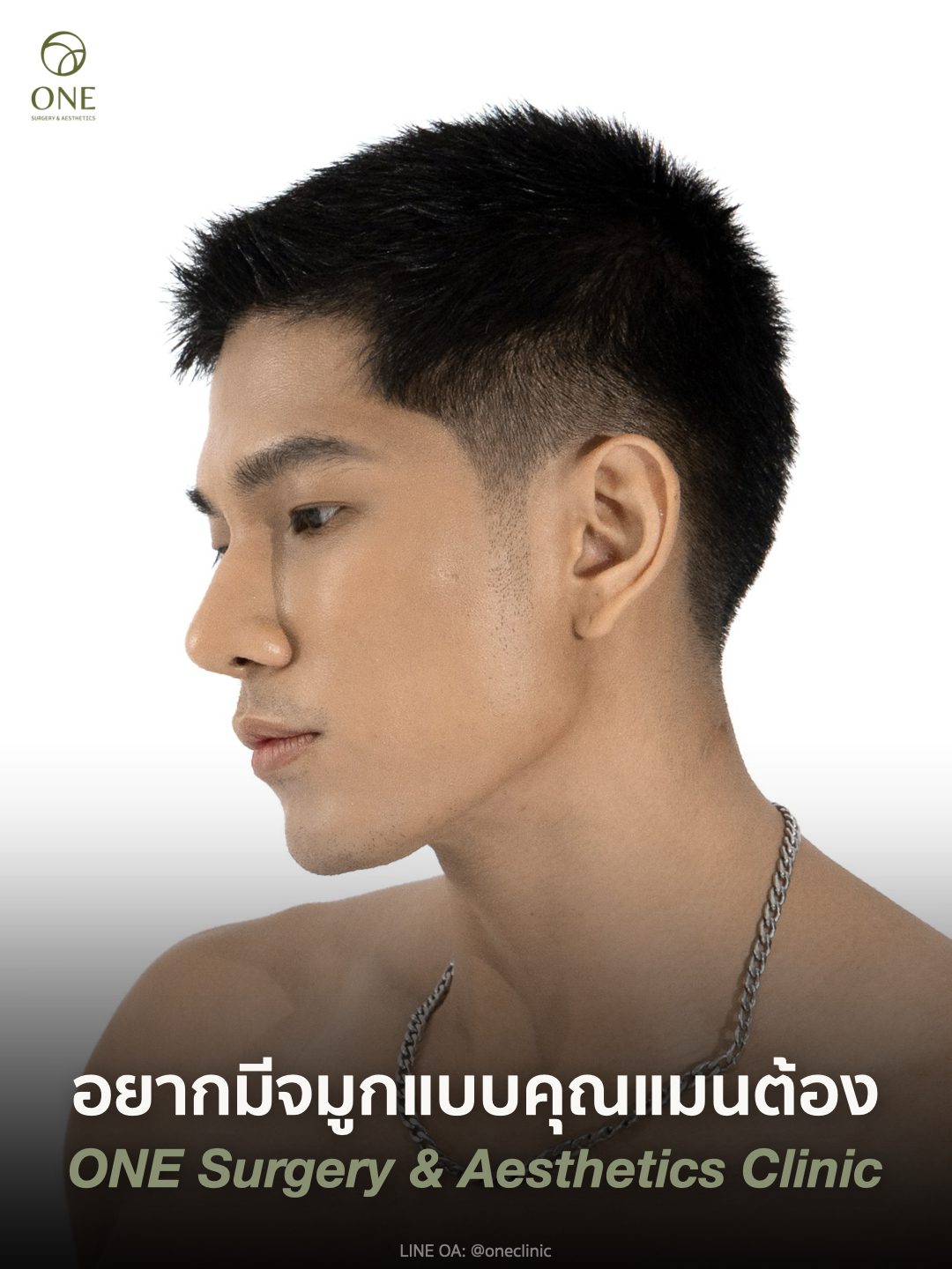 เสริมจมูกโอเพ่น