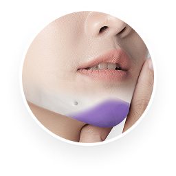 ศัลยกรรมคาง