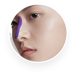 ศัลยกรรมจมูก