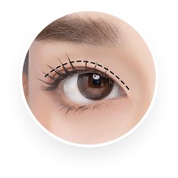 ศัลยกรรมตา