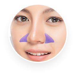 ศัลยกรรมเสริมร่องแก้ม