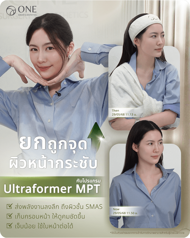 Ulthera Prime ทำจุดไหนได้บ้าง