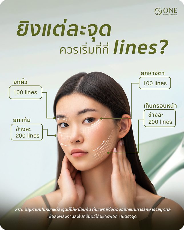 Ulthera Prime ทำจุดไหนได้บ้าง