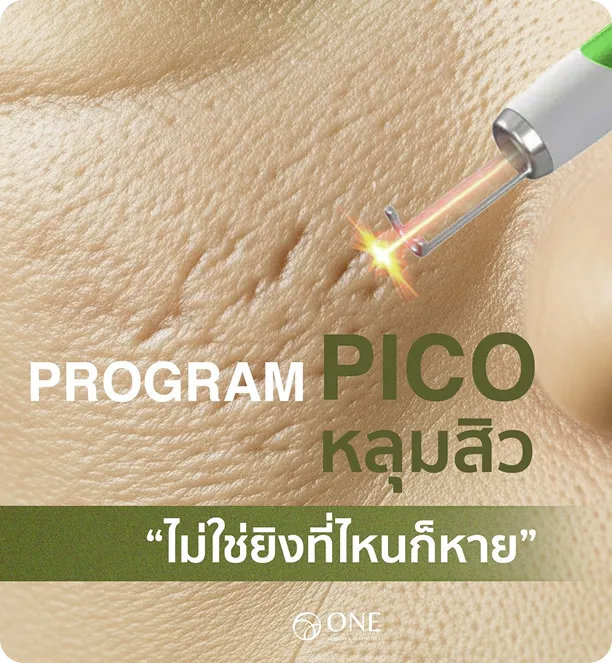 Pico Discovery 2
