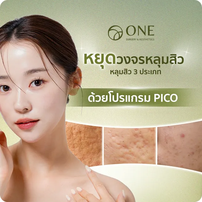Pico Discovery 5