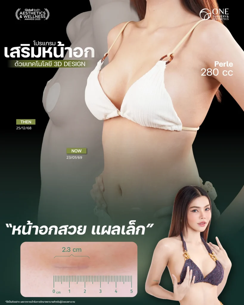 Review เสริมนม Final-01