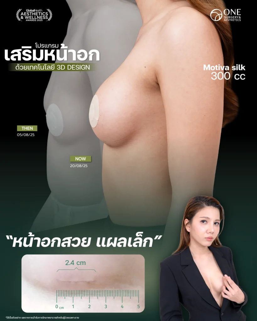 Review เสริมนม Final-02