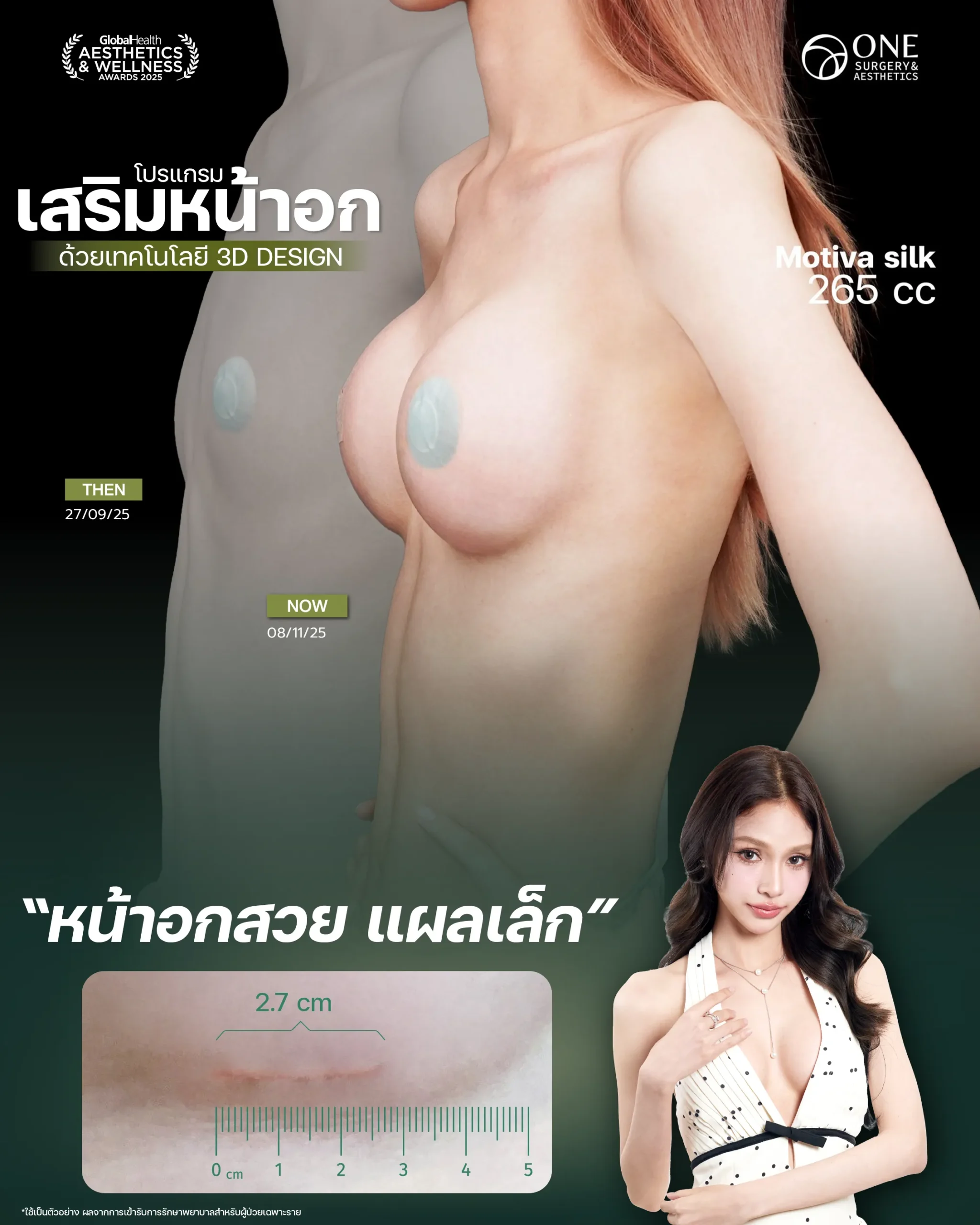 Review เสริมนม Final-04