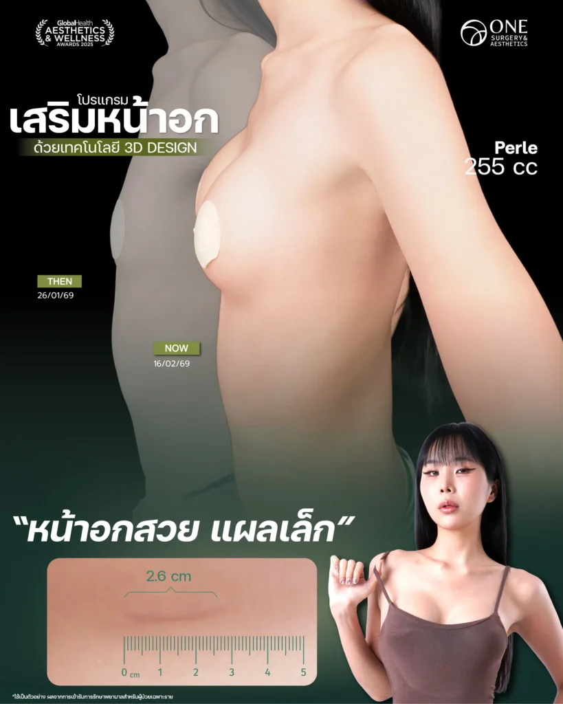 Review เสริมนม Final-08