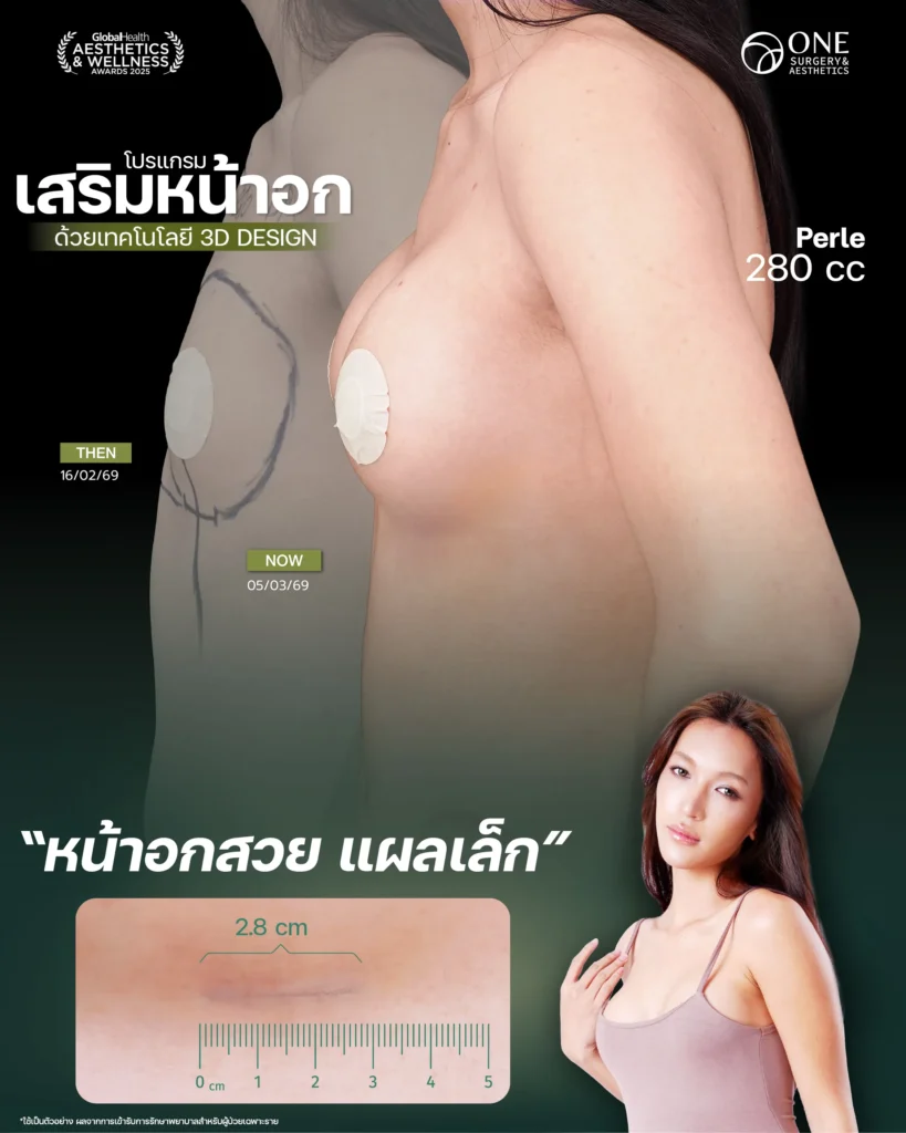 Review เสริมนม Final-09