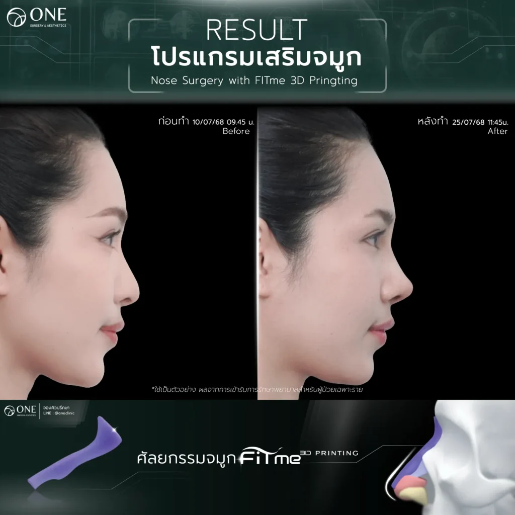 TemplateReview คุณมายด์2