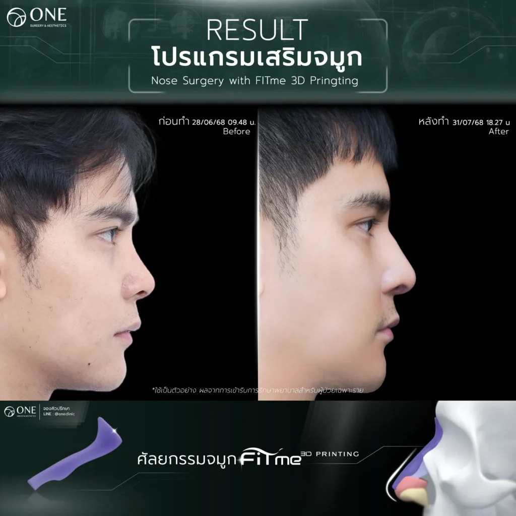 {"type":"elementor","siteurl":"https://one-hospital.com/wp-json/","elements":[{"id":"30045ec","elType":"container","isInner":true,"isLocked":false,"settings":{"flex_direction":"column","content_width":"full","container_type":"flex","width":{"unit":"%","size":"","sizes":[]},"width_widescreen":{"unit":"px","size":"","sizes":[]},"width_tablet":{"unit":"px","size":"","sizes":[]},"width_mobile":{"unit":"px","size":"","sizes":[]},"boxed_width":{"unit":"px","size":"","sizes":[]},"boxed_width_widescreen":{"unit":"px","size":"","sizes":[]},"boxed_width_tablet":{"unit":"px","size":"","sizes":[]},"boxed_width_mobile":{"unit":"px","size":"","sizes":[]},"min_height":{"unit":"px","size":"","sizes":[]},"min_height_widescreen":{"unit":"px","size":"","sizes":[]},"min_height_tablet":{"unit":"px","size":"","sizes":[]},"min_height_mobile":{"unit":"px","size":"","sizes":[]},"flex_direction_widescreen":"","flex_direction_tablet":"","flex_direction_mobile":"","flex__is_row":"row","flex__is_column":"column","flex_justify_content":"","flex_justify_content_widescreen":"","flex_justify_content_tablet":"","flex_justify_content_mobile":"","flex_align_items":"","flex_align_items_widescreen":"","flex_align_items_tablet":"","flex_align_items_mobile":"","flex_gap":{"column":"","row":"","isLinked":true,"unit":"px"},"flex_gap_widescreen":{"column":"","row":"","isLinked":true,"unit":"px"},"flex_gap_tablet":{"column":"","row":"","isLinked":true,"unit":"px"},"flex_gap_mobile":{"column":"","row":"","isLinked":true,"unit":"px"},"flex_wrap":"","flex_wrap_widescreen":"","flex_wrap_tablet":"","flex_wrap_mobile":"","flex_align_content":"","flex_align_content_widescreen":"","flex_align_content_tablet":"","flex_align_content_mobile":"","grid_outline":"yes","grid_columns_grid":{"unit":"fr","size":3,"sizes":[]},"grid_columns_grid_widescreen":{"unit":"fr","size":"","sizes":[]},"grid_columns_grid_tablet":{"unit":"fr","size":"","sizes":[]},"grid_columns_grid_mobile":{"unit":"fr","size":1,"sizes":[]},"grid_rows_grid":{"unit":"fr","size":2,"sizes":[]},"grid_rows_grid_widescreen":{"unit":"fr","size":"","sizes":[]},"grid_rows_grid_tablet":{"unit":"fr","size":"","sizes":[]},"grid_rows_grid_mobile":{"unit":"fr","size":"","sizes":[]},"grid_gaps":{"column":"","row":"","isLinked":true,"unit":"px"},"grid_gaps_widescreen":{"column":"","row":"","isLinked":true,"unit":"px"},"grid_gaps_tablet":{"column":"","row":"","isLinked":true,"unit":"px"},"grid_gaps_mobile":{"column":"","row":"","isLinked":true,"unit":"px"},"grid_auto_flow":"row","grid_auto_flow_widescreen":"row","grid_auto_flow_tablet":"row","grid_auto_flow_mobile":"row","grid_justify_items":"","grid_justify_items_widescreen":"","grid_justify_items_tablet":"","grid_justify_items_mobile":"","grid_align_items":"","grid_align_items_widescreen":"","grid_align_items_tablet":"","grid_align_items_mobile":"","grid_justify_content":"","grid_justify_content_widescreen":"","grid_justify_content_tablet":"","grid_justify_content_mobile":"","grid_align_content":"","grid_align_content_widescreen":"","grid_align_content_tablet":"","grid_align_content_mobile":"","grid__is_row":"row","grid__is_column":"column","section_for_header":"","overflow":"","html_tag":"","link":{"url":"","is_external":"","nofollow":"","custom_attributes":""},"background_background":"","background_color":"","background_color_stop":{"unit":"%","size":0,"sizes":[]},"background_color_stop_widescreen":{"unit":"%"},"background_color_stop_tablet":{"unit":"%"},"background_color_stop_mobile":{"unit":"%"},"background_color_b":"#f2295b","background_color_b_stop":{"unit":"%","size":100,"sizes":[]},"background_color_b_stop_widescreen":{"unit":"%"},"background_color_b_stop_tablet":{"unit":"%"},"background_color_b_stop_mobile":{"unit":"%"},"background_gradient_type":"linear","background_gradient_angle":{"unit":"deg","size":180,"sizes":[]},"background_gradient_angle_widescreen":{"unit":"deg"},"background_gradient_angle_tablet":{"unit":"deg"},"background_gradient_angle_mobile":{"unit":"deg"},"background_gradient_position":"center center","background_gradient_position_widescreen":"","background_gradient_position_tablet":"","background_gradient_position_mobile":"","background_image":{"url":"","id":"","size":""},"background_image_widescreen":{"url":"","id":"","size":""},"background_image_tablet":{"url":"","id":"","size":""},"background_image_mobile":{"url":"","id":"","size":""},"background_position":"","background_position_widescreen":"","background_position_tablet":"","background_position_mobile":"","background_xpos":{"unit":"px","size":0,"sizes":[]},"background_xpos_widescreen":{"unit":"px","size":"","sizes":[]},"background_xpos_tablet":{"unit":"px","size":0,"sizes":[]},"background_xpos_mobile":{"unit":"px","size":0,"sizes":[]},"background_ypos":{"unit":"px","size":0,"sizes":[]},"background_ypos_widescreen":{"unit":"px","size":"","sizes":[]},"background_ypos_tablet":{"unit":"px","size":0,"sizes":[]},"background_ypos_mobile":{"unit":"px","size":0,"sizes":[]},"background_attachment":"","background_repeat":"","background_repeat_widescreen":"","background_repeat_tablet":"","background_repeat_mobile":"","background_size":"","background_size_widescreen":"","background_size_tablet":"","background_size_mobile":"","background_bg_width":{"unit":"%","size":100,"sizes":[]},"background_bg_width_widescreen":{"unit":"px","size":"","sizes":[]},"background_bg_width_tablet":{"unit":"px","size":"","sizes":[]},"background_bg_width_mobile":{"unit":"px","size":"","sizes":[]},"background_video_link":"","background_video_start":"","background_video_end":"","background_play_once":"","background_play_on_mobile":"","background_privacy_mode":"","background_video_fallback":{"url":"","id":"","size":""},"background_slideshow_gallery":[],"background_slideshow_loop":"yes","background_slideshow_slide_duration":5000,"background_slideshow_slide_transition":"fade","background_slideshow_transition_duration":500,"background_slideshow_background_size":"","background_slideshow_background_size_widescreen":"","background_slideshow_background_size_tablet":"","background_slideshow_background_size_mobile":"","background_slideshow_background_position":"","background_slideshow_background_position_widescreen":"","background_slideshow_background_position_tablet":"","background_slideshow_background_position_mobile":"","background_slideshow_lazyload":"","background_slideshow_ken_burns":"","background_slideshow_ken_burns_zoom_direction":"in","handle_slideshow_asset_loading":"","background_hover_background":"","background_hover_color":"","background_hover_color_stop":{"unit":"%","size":0,"sizes":[]},"background_hover_color_stop_widescreen":{"unit":"%"},"background_hover_color_stop_tablet":{"unit":"%"},"background_hover_color_stop_mobile":{"unit":"%"},"background_hover_color_b":"#f2295b","background_hover_color_b_stop":{"unit":"%","size":100,"sizes":[]},"background_hover_color_b_stop_widescreen":{"unit":"%"},"background_hover_color_b_stop_tablet":{"unit":"%"},"background_hover_color_b_stop_mobile":{"unit":"%"},"background_hover_gradient_type":"linear","background_hover_gradient_angle":{"unit":"deg","size":180,"sizes":[]},"background_hover_gradient_angle_widescreen":{"unit":"deg"},"background_hover_gradient_angle_tablet":{"unit":"deg"},"background_hover_gradient_angle_mobile":{"unit":"deg"},"background_hover_gradient_position":"center center","background_hover_gradient_position_widescreen":"","background_hover_gradient_position_tablet":"","background_hover_gradient_position_mobile":"","background_hover_image":{"url":"","id":"","size":""},"background_hover_image_widescreen":{"url":"","id":"","size":""},"background_hover_image_tablet":{"url":"","id":"","size":""},"background_hover_image_mobile":{"url":"","id":"","size":""},"background_hover_position":"","background_hover_position_widescreen":"","background_hover_position_tablet":"","background_hover_position_mobile":"","background_hover_xpos":{"unit":"px","size":0,"sizes":[]},"background_hover_xpos_widescreen":{"unit":"px","size":"","sizes":[]},"background_hover_xpos_tablet":{"unit":"px","size":0,"sizes":[]},"background_hover_xpos_mobile":{"unit":"px","size":0,"sizes":[]},"background_hover_ypos":{"unit":"px","size":0,"sizes":[]},"background_hover_ypos_widescreen":{"unit":"px","size":"","sizes":[]},"background_hover_ypos_tablet":{"unit":"px","size":0,"sizes":[]},"background_hover_ypos_mobile":{"unit":"px","size":0,"sizes":[]},"background_hover_attachment":"","background_hover_repeat":"","background_hover_repeat_widescreen":"","background_hover_repeat_tablet":"","background_hover_repeat_mobile":"","background_hover_size":"","background_hover_size_widescreen":"","background_hover_size_tablet":"","background_hover_size_mobile":"","background_hover_bg_width":{"unit":"%","size":100,"sizes":[]},"background_hover_bg_width_widescreen":{"unit":"px","size":"","sizes":[]},"background_hover_bg_width_tablet":{"unit":"px","size":"","sizes":[]},"background_hover_bg_width_mobile":{"unit":"px","size":"","sizes":[]},"background_hover_video_link":"","background_hover_video_start":"","background_hover_video_end":"","background_hover_play_once":"","background_hover_play_on_mobile":"","background_hover_privacy_mode":"","background_hover_video_fallback":{"url":"","id":"","size":""},"background_hover_slideshow_gallery":[],"background_hover_slideshow_loop":"yes","background_hover_slideshow_slide_duration":5000,"background_hover_slideshow_slide_transition":"fade","background_hover_slideshow_transition_duration":500,"background_hover_slideshow_background_size":"","background_hover_slideshow_background_size_widescreen":"","background_hover_slideshow_background_size_tablet":"","background_hover_slideshow_background_size_mobile":"","background_hover_slideshow_background_position":"","background_hover_slideshow_background_position_widescreen":"","background_hover_slideshow_background_position_tablet":"","background_hover_slideshow_background_position_mobile":"","background_hover_slideshow_lazyload":"","background_hover_slideshow_ken_burns":"","background_hover_slideshow_ken_burns_zoom_direction":"in","background_hover_transition":{"unit":"px","size":0.3,"sizes":[]},"cms_bg_effect_type":"","cms_bg_scroll_effects":"","cms_bg_scroll_vertical":"yes","cms_bg_scroll_vertical_speed":{"unit":"px","size":4,"sizes":[]},"cms_bg_scroll_vertical_direction":"default","cms_bg_scroll_vertical_timing":"linear","cms_bg_scroll_horizontal":"yes","cms_bg_scroll_horizontal_speed":{"unit":"px","size":4,"sizes":[]},"cms_bg_scroll_horizontal_direction":"default","cms_bg_scroll_horizontal_timing":"linear","cms_bg_scroll_scale":"yes","cms_bg_scroll_scale_speed":{"unit":"px","size":4,"sizes":[]},"cms_bg_scroll_scale_direction":"default","cms_bg_scroll_scale_timing":"linear","cms_bg_scroll_opacity":"yes","cms_bg_scroll_opacity_speed":{"unit":"px","size":10,"sizes":[]},"cms_bg_scroll_opacity_direction":"default","cms_bg_scroll_opacity_timing":"expoOut","cms_bg_scroll_blur":"yes","cms_bg_scroll_blur_speed":{"unit":"px","size":4,"sizes":[]},"cms_bg_scroll_blur_direction":"default","cms_bg_scroll_blur_timing":"expoOut","cms_bg_scroll_grayscale":"yes","cms_bg_scroll_grayscale_speed":{"unit":"px","size":10,"sizes":[]},"cms_bg_scroll_grayscale_direction":"default","cms_bg_scroll_grayscale_timing":"expoOut","cms_bg_scroll_sepia":"yes","cms_bg_scroll_sepia_speed":{"unit":"px","size":10,"sizes":[]},"cms_bg_scroll_sepia_direction":"default","cms_bg_scroll_sepia_timing":"expoOut","cms_bg_scroll_saturate":"yes","cms_bg_scroll_saturate_speed":{"unit":"px","size":4,"sizes":[]},"cms_bg_scroll_saturate_direction":"default","cms_bg_scroll_saturate_timing":"expoOut","cms_bg_scroll_brightness":"yes","cms_bg_scroll_brightness_speed":{"unit":"px","size":4,"sizes":[]},"cms_bg_scroll_brightness_direction":"default","cms_bg_scroll_brightness_timing":"expoOut","cms_bg_scroll_contrast":"yes","cms_bg_scroll_contrast_speed":{"unit":"px","size":4,"sizes":[]},"cms_bg_scroll_contrast_direction":"default","cms_bg_scroll_contrast_timing":"expoOut","cms_bg_scroll_huerotate":"yes","cms_bg_scroll_huerotate_speed":{"unit":"px","size":10,"sizes":[]},"cms_bg_scroll_huerotate_direction":"default","cms_bg_scroll_huerotate_timing":"expoOut","cms_bg_scroll_viewport":{"unit":"%","size":"","sizes":{"start":0,"end":100}},"cms_bg_scroll_range":"viewport","cms_bg_scroll_devices":["desktop","tablet","mobile"],"cms_bg_tilt_axis":"both","cms_bg_tilt_shift":{"unit":"px","size":1,"sizes":[]},"cms_bg_tilt_scale":{"unit":"px","size":1,"sizes":[]},"cms_bg_tilt_advanced":"","cms_bg_tilt_shift_direction":"reverse","cms_bg_tilt_speed":{"unit":"px","size":1,"sizes":[]},"cms_bg_tilt_reset":"yes","cms_bg_tilt_devices":["desktop","tablet","mobile"],"cms_bg_floating_translate_toggle":"","cms_bg_floating_translate_x":{"unit":"%","size":"","sizes":{"from":-15,"to":15}},"cms_bg_floating_translate_y":{"unit":"%","size":"","sizes":{"from":-15,"to":15}},"cms_bg_floating_translate_delay":{"unit":"px","size":"","sizes":[]},"cms_bg_floating_scale_toggle":"","cms_bg_floating_scale_type":"simple","cms_bg_floating_scale":{"unit":"x","size":"","sizes":{"from":1,"to":1.2}},"cms_bg_floating_scale_x":{"unit":"x","size":"","sizes":{"from":1,"to":1.2}},"cms_bg_floating_scale_y":{"unit":"x","size":"","sizes":{"from":1,"to":1.2}},"cms_bg_floating_scale_delay":{"unit":"px","size":"","sizes":[]},"cms_bg_floating_duration":{"unit":"px","size":3,"sizes":[]},"cms_bg_hide_bg":"none","background_motion_fx_motion_fx_scrolling":"","background_motion_fx_translateY_effect":"","background_motion_fx_translateY_direction":"","background_motion_fx_translateY_speed":{"unit":"px","size":4,"sizes":[]},"background_motion_fx_translateY_affectedRange":{"unit":"%","size":"","sizes":{"start":0,"end":100}},"background_motion_fx_translateX_effect":"","background_motion_fx_translateX_direction":"","background_motion_fx_translateX_speed":{"unit":"px","size":4,"sizes":[]},"background_motion_fx_translateX_affectedRange":{"unit":"%","size":"","sizes":{"start":0,"end":100}},"background_motion_fx_opacity_effect":"","background_motion_fx_opacity_direction":"out-in","background_motion_fx_opacity_level":{"unit":"px","size":10,"sizes":[]},"background_motion_fx_opacity_range":{"unit":"%","size":"","sizes":{"start":20,"end":80}},"background_motion_fx_blur_effect":"","background_motion_fx_blur_direction":"out-in","background_motion_fx_blur_level":{"unit":"px","size":7,"sizes":[]},"background_motion_fx_blur_range":{"unit":"%","size":"","sizes":{"start":20,"end":80}},"background_motion_fx_rotateZ_direction":"","background_motion_fx_rotateZ_speed":{"unit":"px","size":1,"sizes":[]},"background_motion_fx_rotateZ_affectedRange":{"unit":"%","size":"","sizes":{"start":0,"end":100}},"background_motion_fx_scale_effect":"","background_motion_fx_scale_direction":"out-in","background_motion_fx_scale_speed":{"unit":"px","size":4,"sizes":[]},"background_motion_fx_scale_range":{"unit":"%","size":"","sizes":{"start":20,"end":80}},"background_motion_fx_devices":["widescreen","desktop","tablet","mobile"],"background_motion_fx_range":"","background_motion_fx_motion_fx_mouse":"","background_motion_fx_mouseTrack_effect":"","background_motion_fx_mouseTrack_direction":"","background_motion_fx_mouseTrack_speed":{"unit":"px","size":1,"sizes":[]},"background_motion_fx_tilt_direction":"","background_motion_fx_tilt_speed":{"unit":"px","size":4,"sizes":[]},"background_handle_motion_fx_asset_loading":"","background_overlay_background":"","background_overlay_color":"","background_overlay_color_stop":{"unit":"%","size":0,"sizes":[]},"background_overlay_color_stop_widescreen":{"unit":"%"},"background_overlay_color_stop_tablet":{"unit":"%"},"background_overlay_color_stop_mobile":{"unit":"%"},"background_overlay_color_b":"#f2295b","background_overlay_color_b_stop":{"unit":"%","size":100,"sizes":[]},"background_overlay_color_b_stop_widescreen":{"unit":"%"},"background_overlay_color_b_stop_tablet":{"unit":"%"},"background_overlay_color_b_stop_mobile":{"unit":"%"},"background_overlay_gradient_type":"linear","background_overlay_gradient_angle":{"unit":"deg","size":180,"sizes":[]},"background_overlay_gradient_angle_widescreen":{"unit":"deg"},"background_overlay_gradient_angle_tablet":{"unit":"deg"},"background_overlay_gradient_angle_mobile":{"unit":"deg"},"background_overlay_gradient_position":"center center","background_overlay_gradient_position_widescreen":"","background_overlay_gradient_position_tablet":"","background_overlay_gradient_position_mobile":"","background_overlay_image":{"url":"","id":"","size":""},"background_overlay_image_widescreen":{"url":"","id":"","size":""},"background_overlay_image_tablet":{"url":"","id":"","size":""},"background_overlay_image_mobile":{"url":"","id":"","size":""},"background_overlay_position":"","background_overlay_position_widescreen":"","background_overlay_position_tablet":"","background_overlay_position_mobile":"","background_overlay_xpos":{"unit":"px","size":0,"sizes":[]},"background_overlay_xpos_widescreen":{"unit":"px","size":"","sizes":[]},"background_overlay_xpos_tablet":{"unit":"px","size":0,"sizes":[]},"background_overlay_xpos_mobile":{"unit":"px","size":0,"sizes":[]},"background_overlay_ypos":{"unit":"px","size":0,"sizes":[]},"background_overlay_ypos_widescreen":{"unit":"px","size":"","sizes":[]},"background_overlay_ypos_tablet":{"unit":"px","size":0,"sizes":[]},"background_overlay_ypos_mobile":{"unit":"px","size":0,"sizes":[]},"background_overlay_attachment":"","background_overlay_repeat":"","background_overlay_repeat_widescreen":"","background_overlay_repeat_tablet":"","background_overlay_repeat_mobile":"","background_overlay_size":"","background_overlay_size_widescreen":"","background_overlay_size_tablet":"","background_overlay_size_mobile":"","background_overlay_bg_width":{"unit":"%","size":100,"sizes":[]},"background_overlay_bg_width_widescreen":{"unit":"px","size":"","sizes":[]},"background_overlay_bg_width_tablet":{"unit":"px","size":"","sizes":[]},"background_overlay_bg_width_mobile":{"unit":"px","size":"","sizes":[]},"background_overlay_video_link":"","background_overlay_video_start":"","background_overlay_video_end":"","background_overlay_play_once":"","background_overlay_play_on_mobile":"","background_overlay_privacy_mode":"","background_overlay_video_fallback":{"url":"","id":"","size":""},"background_overlay_slideshow_gallery":[],"background_overlay_slideshow_loop":"yes","background_overlay_slideshow_slide_duration":5000,"background_overlay_slideshow_slide_transition":"fade","background_overlay_slideshow_transition_duration":500,"background_overlay_slideshow_background_size":"","background_overlay_slideshow_background_size_widescreen":"","background_overlay_slideshow_background_size_tablet":"","background_overlay_slideshow_background_size_mobile":"","background_overlay_slideshow_background_position":"","background_overlay_slideshow_background_position_widescreen":"","background_overlay_slideshow_background_position_tablet":"","background_overlay_slideshow_background_position_mobile":"","background_overlay_slideshow_lazyload":"","background_overlay_slideshow_ken_burns":"","background_overlay_slideshow_ken_burns_zoom_direction":"in","background_overlay_opacity":{"unit":"px","size":0.5,"sizes":[]},"background_overlay_opacity_widescreen":{"unit":"px","size":"","sizes":[]},"background_overlay_opacity_tablet":{"unit":"px","size":"","sizes":[]},"background_overlay_opacity_mobile":{"unit":"px","size":"","sizes":[]},"css_filters_css_filter":"","css_filters_blur":{"unit":"px","size":0,"sizes":[]},"css_filters_brightness":{"unit":"px","size":100,"sizes":[]},"css_filters_contrast":{"unit":"px","size":100,"sizes":[]},"css_filters_saturate":{"unit":"px","size":100,"sizes":[]},"css_filters_hue":{"unit":"px","size":0,"sizes":[]},"overlay_blend_mode":"","background_overlay_hover_background":"","background_overlay_hover_color":"","background_overlay_hover_color_stop":{"unit":"%","size":0,"sizes":[]},"background_overlay_hover_color_stop_widescreen":{"unit":"%"},"background_overlay_hover_color_stop_tablet":{"unit":"%"},"background_overlay_hover_color_stop_mobile":{"unit":"%"},"background_overlay_hover_color_b":"#f2295b","background_overlay_hover_color_b_stop":{"unit":"%","size":100,"sizes":[]},"background_overlay_hover_color_b_stop_widescreen":{"unit":"%"},"background_overlay_hover_color_b_stop_tablet":{"unit":"%"},"background_overlay_hover_color_b_stop_mobile":{"unit":"%"},"background_overlay_hover_gradient_type":"linear","background_overlay_hover_gradient_angle":{"unit":"deg","size":180,"sizes":[]},"background_overlay_hover_gradient_angle_widescreen":{"unit":"deg"},"background_overlay_hover_gradient_angle_tablet":{"unit":"deg"},"background_overlay_hover_gradient_angle_mobile":{"unit":"deg"},"background_overlay_hover_gradient_position":"center center","background_overlay_hover_gradient_position_widescreen":"","background_overlay_hover_gradient_position_tablet":"","background_overlay_hover_gradient_position_mobile":"","background_overlay_hover_image":{"url":"","id":"","size":""},"background_overlay_hover_image_widescreen":{"url":"","id":"","size":""},"background_overlay_hover_image_tablet":{"url":"","id":"","size":""},"background_overlay_hover_image_mobile":{"url":"","id":"","size":""},"background_overlay_hover_position":"","background_overlay_hover_position_widescreen":"","background_overlay_hover_position_tablet":"","background_overlay_hover_position_mobile":"","background_overlay_hover_xpos":{"unit":"px","size":0,"sizes":[]},"background_overlay_hover_xpos_widescreen":{"unit":"px","size":"","sizes":[]},"background_overlay_hover_xpos_tablet":{"unit":"px","size":0,"sizes":[]},"background_overlay_hover_xpos_mobile":{"unit":"px","size":0,"sizes":[]},"background_overlay_hover_ypos":{"unit":"px","size":0,"sizes":[]},"background_overlay_hover_ypos_widescreen":{"unit":"px","size":"","sizes":[]},"background_overlay_hover_ypos_tablet":{"unit":"px","size":0,"sizes":[]},"background_overlay_hover_ypos_mobile":{"unit":"px","size":0,"sizes":[]},"background_overlay_hover_attachment":"","background_overlay_hover_repeat":"","background_overlay_hover_repeat_widescreen":"","background_overlay_hover_repeat_tablet":"","background_overlay_hover_repeat_mobile":"","background_overlay_hover_size":"","background_overlay_hover_size_widescreen":"","background_overlay_hover_size_tablet":"","background_overlay_hover_size_mobile":"","background_overlay_hover_bg_width":{"unit":"%","size":100,"sizes":[]},"background_overlay_hover_bg_width_widescreen":{"unit":"px","size":"","sizes":[]},"background_overlay_hover_bg_width_tablet":{"unit":"px","size":"","sizes":[]},"background_overlay_hover_bg_width_mobile":{"unit":"px","size":"","sizes":[]},"background_overlay_hover_video_link":"","background_overlay_hover_video_start":"","background_overlay_hover_video_end":"","background_overlay_hover_play_once":"","background_overlay_hover_play_on_mobile":"","background_overlay_hover_privacy_mode":"","background_overlay_hover_video_fallback":{"url":"","id":"","size":""},"background_overlay_hover_slideshow_gallery":[],"background_overlay_hover_slideshow_loop":"yes","background_overlay_hover_slideshow_slide_duration":5000,"background_overlay_hover_slideshow_slide_transition":"fade","background_overlay_hover_slideshow_transition_duration":500,"background_overlay_hover_slideshow_background_size":"","background_overlay_hover_slideshow_background_size_widescreen":"","background_overlay_hover_slideshow_background_size_tablet":"","background_overlay_hover_slideshow_background_size_mobile":"","background_overlay_hover_slideshow_background_position":"","background_overlay_hover_slideshow_background_position_widescreen":"","background_overlay_hover_slideshow_background_position_tablet":"","background_overlay_hover_slideshow_background_position_mobile":"","background_overlay_hover_slideshow_lazyload":"","background_overlay_hover_slideshow_ken_burns":"","background_overlay_hover_slideshow_ken_burns_zoom_direction":"in","background_overlay_hover_opacity":{"unit":"px","size":0.5,"sizes":[]},"background_overlay_hover_opacity_widescreen":{"unit":"px","size":"","sizes":[]},"background_overlay_hover_opacity_tablet":{"unit":"px","size":"","sizes":[]},"background_overlay_hover_opacity_mobile":{"unit":"px","size":"","sizes":[]},"background_overlay_hover_transition":{"unit":"px","size":"","sizes":[]},"css_filters_hover_css_filter":"","css_filters_hover_blur":{"unit":"px","size":0,"sizes":[]},"css_filters_hover_brightness":{"unit":"px","size":100,"sizes":[]},"css_filters_hover_contrast":{"unit":"px","size":100,"sizes":[]},"css_filters_hover_saturate":{"unit":"px","size":100,"sizes":[]},"css_filters_hover_hue":{"unit":"px","size":0,"sizes":[]},"border_border":"","border_width":{"unit":"px","top":"","right":"","bottom":"","left":"","isLinked":true},"border_width_widescreen":{"unit":"px","top":"","right":"","bottom":"","left":"","isLinked":true},"border_width_tablet":{"unit":"px","top":"","right":"","bottom":"","left":"","isLinked":true},"border_width_mobile":{"unit":"px","top":"","right":"","bottom":"","left":"","isLinked":true},"border_color":"","border_radius":{"unit":"px","top":"","right":"","bottom":"","left":"","isLinked":true},"border_radius_widescreen":{"unit":"px","top":"","right":"","bottom":"","left":"","isLinked":true},"border_radius_tablet":{"unit":"px","top":"","right":"","bottom":"","left":"","isLinked":true},"border_radius_mobile":{"unit":"px","top":"","right":"","bottom":"","left":"","isLinked":true},"box_shadow_box_shadow_type":"","box_shadow_box_shadow":{"horizontal":0,"vertical":0,"blur":10,"spread":0,"color":"rgba(0,0,0,0.5)"},"box_shadow_box_shadow_position":" ","border_hover_border":"","border_hover_width":{"unit":"px","top":"","right":"","bottom":"","left":"","isLinked":true},"border_hover_width_widescreen":{"unit":"px","top":"","right":"","bottom":"","left":"","isLinked":true},"border_hover_width_tablet":{"unit":"px","top":"","right":"","bottom":"","left":"","isLinked":true},"border_hover_width_mobile":{"unit":"px","top":"","right":"","bottom":"","left":"","isLinked":true},"border_hover_color":"","border_radius_hover":{"unit":"px","top":"","right":"","bottom":"","left":"","isLinked":true},"border_radius_hover_widescreen":{"unit":"px","top":"","right":"","bottom":"","left":"","isLinked":true},"border_radius_hover_tablet":{"unit":"px","top":"","right":"","bottom":"","left":"","isLinked":true},"border_radius_hover_mobile":{"unit":"px","top":"","right":"","bottom":"","left":"","isLinked":true},"box_shadow_hover_box_shadow_type":"","box_shadow_hover_box_shadow":{"horizontal":0,"vertical":0,"blur":10,"spread":0,"color":"rgba(0,0,0,0.5)"},"box_shadow_hover_box_shadow_position":" ","border_hover_transition":{"unit":"px","size":0.3,"sizes":[]},"shape_divider_top":"","shape_divider_top_color":"","shape_divider_top_width":{"unit":"%","size":"","sizes":[]},"shape_divider_top_width_widescreen":{"unit":"px","size":"","sizes":[]},"shape_divider_top_width_tablet":{"unit":"%","size":"","sizes":[]},"shape_divider_top_width_mobile":{"unit":"%","size":"","sizes":[]},"shape_divider_top_height":{"unit":"px","size":"","sizes":[]},"shape_divider_top_height_widescreen":{"unit":"px","size":"","sizes":[]},"shape_divider_top_height_tablet":{"unit":"px","size":"","sizes":[]},"shape_divider_top_height_mobile":{"unit":"px","size":"","sizes":[]},"shape_divider_top_flip":"","shape_divider_top_negative":"","shape_divider_top_above_content":"","shape_divider_bottom":"","shape_divider_bottom_color":"","shape_divider_bottom_width":{"unit":"%","size":"","sizes":[]},"shape_divider_bottom_width_widescreen":{"unit":"px","size":"","sizes":[]},"shape_divider_bottom_width_tablet":{"unit":"%","size":"","sizes":[]},"shape_divider_bottom_width_mobile":{"unit":"%","size":"","sizes":[]},"shape_divider_bottom_height":{"unit":"px","size":"","sizes":[]},"shape_divider_bottom_height_widescreen":{"unit":"px","size":"","sizes":[]},"shape_divider_bottom_height_tablet":{"unit":"px","size":"","sizes":[]},"shape_divider_bottom_height_mobile":{"unit":"px","size":"","sizes":[]},"shape_divider_bottom_flip":"","shape_divider_bottom_negative":"","shape_divider_bottom_above_content":"","margin":{"unit":"px","top":"","right":"","bottom":"","left":"","isLinked":true},"margin_widescreen":{"unit":"px","top":"","right":"","bottom":"","left":"","isLinked":true},"margin_tablet":{"unit":"px","top":"","right":"","bottom":"","left":"","isLinked":true},"margin_mobile":{"unit":"px","top":"","right":"","bottom":"","left":"","isLinked":true},"padding":{"unit":"px","top":"","right":"","bottom":"","left":"","isLinked":true},"padding_widescreen":{"unit":"px","top":"","right":"","bottom":"","left":"","isLinked":true},"padding_tablet":{"unit":"px","top":"","right":"","bottom":"","left":"","isLinked":true},"padding_mobile":{"unit":"px","top":"","right":"","bottom":"","left":"","isLinked":true},"grid_column":"","grid_column_widescreen":"","grid_column_tablet":"","grid_column_mobile":"","grid_column_custom":"","grid_column_custom_widescreen":"","grid_column_custom_tablet":"","grid_column_custom_mobile":"","grid_row":"","grid_row_widescreen":"","grid_row_tablet":"","grid_row_mobile":"","grid_row_custom":"","grid_row_custom_widescreen":"","grid_row_custom_tablet":"","grid_row_custom_mobile":"","_flex_align_self":"","_flex_align_self_widescreen":"","_flex_align_self_tablet":"","_flex_align_self_mobile":"","_flex_order":"","_flex_order_widescreen":"","_flex_order_tablet":"","_flex_order_mobile":"","_flex_order_custom":"","_flex_order_custom_widescreen":"","_flex_order_custom_tablet":"","_flex_order_custom_mobile":"","_flex_size":"","_flex_size_widescreen":"","_flex_size_tablet":"","_flex_size_mobile":"","_flex_grow":1,"_flex_grow_widescreen":"","_flex_grow_tablet":"","_flex_grow_mobile":"","_flex_shrink":1,"_flex_shrink_widescreen":"","_flex_shrink_tablet":"","_flex_shrink_mobile":"","position":"","_offset_orientation_h":"start","_offset_x":{"unit":"px","size":0,"sizes":[]},"_offset_x_widescreen":{"unit":"px","size":"","sizes":[]},"_offset_x_tablet":{"unit":"px","size":"","sizes":[]},"_offset_x_mobile":{"unit":"px","size":"","sizes":[]},"_offset_x_end":{"unit":"px","size":0,"sizes":[]},"_offset_x_end_widescreen":{"unit":"px","size":"","sizes":[]},"_offset_x_end_tablet":{"unit":"px","size":"","sizes":[]},"_offset_x_end_mobile":{"unit":"px","size":"","sizes":[]},"_offset_orientation_v":"start","_offset_y":{"unit":"px","size":0,"sizes":[]},"_offset_y_widescreen":{"unit":"px","size":"","sizes":[]},"_offset_y_tablet":{"unit":"px","size":"","sizes":[]},"_offset_y_mobile":{"unit":"px","size":"","sizes":[]},"_offset_y_end":{"unit":"px","size":0,"sizes":[]},"_offset_y_end_widescreen":{"unit":"px","size":"","sizes":[]},"_offset_y_end_tablet":{"unit":"px","size":"","sizes":[]},"_offset_y_end_mobile":{"unit":"px","size":"","sizes":[]},"z_index":"","z_index_widescreen":"","z_index_tablet":"","z_index_mobile":"","_element_id":"","css_classes":"","e_display_conditions":"","cpel_lv_enabled":"","cpel_lv_action":"show","cpel_lv_languages":[],"motion_fx_motion_fx_scrolling":"","motion_fx_translateY_effect":"","motion_fx_translateY_direction":"","motion_fx_translateY_speed":{"unit":"px","size":4,"sizes":[]},"motion_fx_translateY_affectedRange":{"unit":"%","size":"","sizes":{"start":0,"end":100}},"motion_fx_translateX_effect":"","motion_fx_translateX_direction":"","motion_fx_translateX_speed":{"unit":"px","size":4,"sizes":[]},"motion_fx_translateX_affectedRange":{"unit":"%","size":"","sizes":{"start":0,"end":100}},"motion_fx_opacity_effect":"","motion_fx_opacity_direction":"out-in","motion_fx_opacity_level":{"unit":"px","size":10,"sizes":[]},"motion_fx_opacity_range":{"unit":"%","size":"","sizes":{"start":20,"end":80}},"motion_fx_blur_effect":"","motion_fx_blur_direction":"out-in","motion_fx_blur_level":{"unit":"px","size":7,"sizes":[]},"motion_fx_blur_range":{"unit":"%","size":"","sizes":{"start":20,"end":80}},"motion_fx_rotateZ_effect":"","motion_fx_rotateZ_direction":"","motion_fx_rotateZ_speed":{"unit":"px","size":1,"sizes":[]},"motion_fx_rotateZ_affectedRange":{"unit":"%","size":"","sizes":{"start":0,"end":100}},"motion_fx_scale_effect":"","motion_fx_scale_direction":"out-in","motion_fx_scale_speed":{"unit":"px","size":4,"sizes":[]},"motion_fx_scale_range":{"unit":"%","size":"","sizes":{"start":20,"end":80}},"motion_fx_transform_origin_x":"center","motion_fx_transform_origin_y":"center","motion_fx_devices":["widescreen","desktop","tablet","mobile"],"motion_fx_range":"","motion_fx_motion_fx_mouse":"","motion_fx_mouseTrack_effect":"","motion_fx_mouseTrack_direction":"","motion_fx_mouseTrack_speed":{"unit":"px","size":1,"sizes":[]},"motion_fx_tilt_effect":"","motion_fx_tilt_direction":"","motion_fx_tilt_speed":{"unit":"px","size":4,"sizes":[]},"handle_motion_fx_asset_loading":"","sticky":"","sticky_on":["widescreen","desktop","tablet","mobile"],"sticky_offset":0,"sticky_offset_widescreen":"","sticky_offset_tablet":"","sticky_offset_mobile":"","sticky_effects_offset":0,"sticky_effects_offset_widescreen":"","sticky_effects_offset_tablet":"","sticky_effects_offset_mobile":"","sticky_anchor_link_offset":0,"sticky_anchor_link_offset_widescreen":"","sticky_anchor_link_offset_tablet":"","sticky_anchor_link_offset_mobile":"","sticky_parent":"","animation":"","animation_widescreen":"","animation_tablet":"","animation_mobile":"","animation_duration":"","animation_delay":"","_transform_rotate_popover":"","_transform_rotateZ_effect":{"unit":"px","size":"","sizes":[]},"_transform_rotateZ_effect_widescreen":{"unit":"deg","size":"","sizes":[]},"_transform_rotateZ_effect_tablet":{"unit":"deg","size":"","sizes":[]},"_transform_rotateZ_effect_mobile":{"unit":"deg","size":"","sizes":[]},"_transform_rotate_3d":"","_transform_rotateX_effect":{"unit":"px","size":"","sizes":[]},"_transform_rotateX_effect_widescreen":{"unit":"deg","size":"","sizes":[]},"_transform_rotateX_effect_tablet":{"unit":"deg","size":"","sizes":[]},"_transform_rotateX_effect_mobile":{"unit":"deg","size":"","sizes":[]},"_transform_rotateY_effect":{"unit":"px","size":"","sizes":[]},"_transform_rotateY_effect_widescreen":{"unit":"deg","size":"","sizes":[]},"_transform_rotateY_effect_tablet":{"unit":"deg","size":"","sizes":[]},"_transform_rotateY_effect_mobile":{"unit":"deg","size":"","sizes":[]},"_transform_perspective_effect":{"unit":"px","size":"","sizes":[]},"_transform_perspective_effect_widescreen":{"unit":"px","size":"","sizes":[]},"_transform_perspective_effect_tablet":{"unit":"px","size":"","sizes":[]},"_transform_perspective_effect_mobile":{"unit":"px","size":"","sizes":[]},"_transform_translate_popover":"","_transform_translateX_effect":{"unit":"px","size":"","sizes":[]},"_transform_translateX_effect_widescreen":{"unit":"px","size":"","sizes":[]},"_transform_translateX_effect_tablet":{"unit":"px","size":"","sizes":[]},"_transform_translateX_effect_mobile":{"unit":"px","size":"","sizes":[]},"_transform_translateY_effect":{"unit":"px","size":"","sizes":[]},"_transform_translateY_effect_widescreen":{"unit":"px","size":"","sizes":[]},"_transform_translateY_effect_tablet":{"unit":"px","size":"","sizes":[]},"_transform_translateY_effect_mobile":{"unit":"px","size":"","sizes":[]},"_transform_scale_popover":"","_transform_keep_proportions":"yes","_transform_scale_effect":{"unit":"px","size":"","sizes":[]},"_transform_scale_effect_widescreen":{"unit":"px","size":"","sizes":[]},"_transform_scale_effect_tablet":{"unit":"px","size":"","sizes":[]},"_transform_scale_effect_mobile":{"unit":"px","size":"","sizes":[]},"_transform_scaleX_effect":{"unit":"px","size":"","sizes":[]},"_transform_scaleX_effect_widescreen":{"unit":"px","size":"","sizes":[]},"_transform_scaleX_effect_tablet":{"unit":"px","size":"","sizes":[]},"_transform_scaleX_effect_mobile":{"unit":"px","size":"","sizes":[]},"_transform_scaleY_effect":{"unit":"px","size":"","sizes":[]},"_transform_scaleY_effect_widescreen":{"unit":"px","size":"","sizes":[]},"_transform_scaleY_effect_tablet":{"unit":"px","size":"","sizes":[]},"_transform_scaleY_effect_mobile":{"unit":"px","size":"","sizes":[]},"_transform_skew_popover":"","_transform_skewX_effect":{"unit":"px","size":"","sizes":[]},"_transform_skewX_effect_widescreen":{"unit":"deg","size":"","sizes":[]},"_transform_skewX_effect_tablet":{"unit":"deg","size":"","sizes":[]},"_transform_skewX_effect_mobile":{"unit":"deg","size":"","sizes":[]},"_transform_skewY_effect":{"unit":"px","size":"","sizes":[]},"_transform_skewY_effect_widescreen":{"unit":"deg","size":"","sizes":[]},"_transform_skewY_effect_tablet":{"unit":"deg","size":"","sizes":[]},"_transform_skewY_effect_mobile":{"unit":"deg","size":"","sizes":[]},"_transform_flipX_effect":"","_transform_flipY_effect":"","_transform_rotate_popover_hover":"","_transform_rotateZ_effect_hover":{"unit":"px","size":"","sizes":[]},"_transform_rotateZ_effect_hover_widescreen":{"unit":"deg","size":"","sizes":[]},"_transform_rotateZ_effect_hover_tablet":{"unit":"deg","size":"","sizes":[]},"_transform_rotateZ_effect_hover_mobile":{"unit":"deg","size":"","sizes":[]},"_transform_rotate_3d_hover":"","_transform_rotateX_effect_hover":{"unit":"px","size":"","sizes":[]},"_transform_rotateX_effect_hover_widescreen":{"unit":"deg","size":"","sizes":[]},"_transform_rotateX_effect_hover_tablet":{"unit":"deg","size":"","sizes":[]},"_transform_rotateX_effect_hover_mobile":{"unit":"deg","size":"","sizes":[]},"_transform_rotateY_effect_hover":{"unit":"px","size":"","sizes":[]},"_transform_rotateY_effect_hover_widescreen":{"unit":"deg","size":"","sizes":[]},"_transform_rotateY_effect_hover_tablet":{"unit":"deg","size":"","sizes":[]},"_transform_rotateY_effect_hover_mobile":{"unit":"deg","size":"","sizes":[]},"_transform_perspective_effect_hover":{"unit":"px","size":"","sizes":[]},"_transform_perspective_effect_hover_widescreen":{"unit":"px","size":"","sizes":[]},"_transform_perspective_effect_hover_tablet":{"unit":"px","size":"","sizes":[]},"_transform_perspective_effect_hover_mobile":{"unit":"px","size":"","sizes":[]},"_transform_translate_popover_hover":"","_transform_translateX_effect_hover":{"unit":"px","size":"","sizes":[]},"_transform_translateX_effect_hover_widescreen":{"unit":"px","size":"","sizes":[]},"_transform_translateX_effect_hover_tablet":{"unit":"px","size":"","sizes":[]},"_transform_translateX_effect_hover_mobile":{"unit":"px","size":"","sizes":[]},"_transform_translateY_effect_hover":{"unit":"px","size":"","sizes":[]},"_transform_translateY_effect_hover_widescreen":{"unit":"px","size":"","sizes":[]},"_transform_translateY_effect_hover_tablet":{"unit":"px","size":"","sizes":[]},"_transform_translateY_effect_hover_mobile":{"unit":"px","size":"","sizes":[]},"_transform_scale_popover_hover":"","_transform_keep_proportions_hover":"yes","_transform_scale_effect_hover":{"unit":"px","size":"","sizes":[]},"_transform_scale_effect_hover_widescreen":{"unit":"px","size":"","sizes":[]},"_transform_scale_effect_hover_tablet":{"unit":"px","size":"","sizes":[]},"_transform_scale_effect_hover_mobile":{"unit":"px","size":"","sizes":[]},"_transform_scaleX_effect_hover":{"unit":"px","size":"","sizes":[]},"_transform_scaleX_effect_hover_widescreen":{"unit":"px","size":"","sizes":[]},"_transform_scaleX_effect_hover_tablet":{"unit":"px","size":"","sizes":[]},"_transform_scaleX_effect_hover_mobile":{"unit":"px","size":"","sizes":[]},"_transform_scaleY_effect_hover":{"unit":"px","size":"","sizes":[]},"_transform_scaleY_effect_hover_widescreen":{"unit":"px","size":"","sizes":[]},"_transform_scaleY_effect_hover_tablet":{"unit":"px","size":"","sizes":[]},"_transform_scaleY_effect_hover_mobile":{"unit":"px","size":"","sizes":[]},"_transform_skew_popover_hover":"","_transform_skewX_effect_hover":{"unit":"px","size":"","sizes":[]},"_transform_skewX_effect_hover_widescreen":{"unit":"deg","size":"","sizes":[]},"_transform_skewX_effect_hover_tablet":{"unit":"deg","size":"","sizes":[]},"_transform_skewX_effect_hover_mobile":{"unit":"deg","size":"","sizes":[]},"_transform_skewY_effect_hover":{"unit":"px","size":"","sizes":[]},"_transform_skewY_effect_hover_widescreen":{"unit":"deg","size":"","sizes":[]},"_transform_skewY_effect_hover_tablet":{"unit":"deg","size":"","sizes":[]},"_transform_skewY_effect_hover_mobile":{"unit":"deg","size":"","sizes":[]},"_transform_flipX_effect_hover":"","_transform_flipY_effect_hover":"","_transform_transition_hover":{"unit":"px","size":"","sizes":[]},"motion_fx_transform_x_anchor_point":"","motion_fx_transform_x_anchor_point_widescreen":"","motion_fx_transform_x_anchor_point_tablet":"","motion_fx_transform_x_anchor_point_mobile":"","motion_fx_transform_y_anchor_point":"","motion_fx_transform_y_anchor_point_widescreen":"","motion_fx_transform_y_anchor_point_tablet":"","motion_fx_transform_y_anchor_point_mobile":"","hide_widescreen":"","hide_desktop":"","hide_tablet":"","hide_mobile":"","cms_effect_type":"","cms_transform_in":1,"cms_transform_in_widescreen":"","cms_transform_in_tablet":"","cms_transform_in_mobile":"","cms_transform_translate_toggle":"","cms_transform_translate_x":{"unit":"px","size":0,"sizes":[]},"cms_transform_translate_x_widescreen":{"unit":"px","size":"","sizes":[]},"cms_transform_translate_x_tablet":{"unit":"px","size":"","sizes":[]},"cms_transform_translate_x_mobile":{"unit":"px","size":"","sizes":[]},"cms_transform_translate_y":{"unit":"px","size":0,"sizes":[]},"cms_transform_translate_y_widescreen":{"unit":"px","size":"","sizes":[]},"cms_transform_translate_y_tablet":{"unit":"px","size":"","sizes":[]},"cms_transform_translate_y_mobile":{"unit":"px","size":"","sizes":[]},"cms_transform_rotate_toggle":"","cms_transform_rotate_type":"simple","cms_transform_rotate":{"unit":"deg","size":0,"sizes":[]},"cms_transform_rotate_widescreen":{"unit":"px","size":"","sizes":[]},"cms_transform_rotate_tablet":{"unit":"deg","size":"","sizes":[]},"cms_transform_rotate_mobile":{"unit":"deg","size":"","sizes":[]},"cms_transform_rotate_z":{"unit":"deg","size":0,"sizes":[]},"cms_transform_rotate_z_widescreen":{"unit":"px","size":"","sizes":[]},"cms_transform_rotate_z_tablet":{"unit":"deg","size":"","sizes":[]},"cms_transform_rotate_z_mobile":{"unit":"deg","size":"","sizes":[]},"cms_transform_rotate_x":{"unit":"deg","size":0,"sizes":[]},"cms_transform_rotate_x_widescreen":{"unit":"px","size":"","sizes":[]},"cms_transform_rotate_x_tablet":{"unit":"deg","size":"","sizes":[]},"cms_transform_rotate_x_mobile":{"unit":"deg","size":"","sizes":[]},"cms_transform_rotate_y":{"unit":"deg","size":0,"sizes":[]},"cms_transform_rotate_y_widescreen":{"unit":"px","size":"","sizes":[]},"cms_transform_rotate_y_tablet":{"unit":"deg","size":"","sizes":[]},"cms_transform_rotate_y_mobile":{"unit":"deg","size":"","sizes":[]},"cms_transform_scale_toggle":"","cms_transform_scale_type":"simple","cms_transform_scale":{"unit":"x","size":1,"sizes":[]},"cms_transform_scale_widescreen":{"unit":"px","size":"","sizes":[]},"cms_transform_scale_tablet":{"unit":"x","size":"","sizes":[]},"cms_transform_scale_mobile":{"unit":"x","size":"","sizes":[]},"cms_transform_scale_x":{"unit":"x","size":1,"sizes":[]},"cms_transform_scale_x_widescreen":{"unit":"px","size":"","sizes":[]},"cms_transform_scale_x_tablet":{"unit":"x","size":"","sizes":[]},"cms_transform_scale_x_mobile":{"unit":"x","size":"","sizes":[]},"cms_transform_scale_y":{"unit":"x","size":1,"sizes":[]},"cms_transform_scale_y_widescreen":{"unit":"px","size":"","sizes":[]},"cms_transform_scale_y_tablet":{"unit":"x","size":"","sizes":[]},"cms_transform_scale_y_mobile":{"unit":"x","size":"","sizes":[]},"cms_transform_skew_toggle":"","cms_transform_skew_x":{"unit":"deg","size":0,"sizes":[]},"cms_transform_skew_x_widescreen":{"unit":"px","size":"","sizes":[]},"cms_transform_skew_x_tablet":{"unit":"deg","size":"","sizes":[]},"cms_transform_skew_x_mobile":{"unit":"deg","size":"","sizes":[]},"cms_transform_skew_y":{"unit":"deg","size":0,"sizes":[]},"cms_transform_skew_y_widescreen":{"unit":"px","size":"","sizes":[]},"cms_transform_skew_y_tablet":{"unit":"deg","size":"","sizes":[]},"cms_transform_skew_y_mobile":{"unit":"deg","size":"","sizes":[]},"cms_transform_opacity_toggle":"","cms_transform_opacity":{"unit":"px","size":1,"sizes":[]},"cms_transform_opacity_widescreen":{"unit":"px","size":"","sizes":[]},"cms_transform_opacity_tablet":{"unit":"px","size":"","sizes":[]},"cms_transform_opacity_mobile":{"unit":"px","size":"","sizes":[]},"cms_transform_blur_toggle":"","cms_transform_blur":{"unit":"px","size":0,"sizes":[]},"cms_transform_blur_widescreen":{"unit":"px","size":"","sizes":[]},"cms_transform_blur_tablet":{"unit":"px","size":"","sizes":[]},"cms_transform_blur_mobile":{"unit":"px","size":"","sizes":[]},"cms_transform_translate_toggle_hover":"","cms_transform_translate_x_hover":{"unit":"px","size":0,"sizes":[]},"cms_transform_translate_x_hover_widescreen":{"unit":"px","size":"","sizes":[]},"cms_transform_translate_x_hover_tablet":{"unit":"px","size":"","sizes":[]},"cms_transform_translate_x_hover_mobile":{"unit":"px","size":"","sizes":[]},"cms_transform_translate_y_hover":{"unit":"px","size":0,"sizes":[]},"cms_transform_translate_y_hover_widescreen":{"unit":"px","size":"","sizes":[]},"cms_transform_translate_y_hover_tablet":{"unit":"px","size":"","sizes":[]},"cms_transform_translate_y_hover_mobile":{"unit":"px","size":"","sizes":[]},"cms_transform_rotate_toggle_hover":"","cms_transform_rotate_type_hover":"simple","cms_transform_rotate_hover":{"unit":"deg","size":0,"sizes":[]},"cms_transform_rotate_hover_widescreen":{"unit":"px","size":"","sizes":[]},"cms_transform_rotate_hover_tablet":{"unit":"deg","size":"","sizes":[]},"cms_transform_rotate_hover_mobile":{"unit":"deg","size":"","sizes":[]},"cms_transform_rotate_z_hover":{"unit":"deg","size":0,"sizes":[]},"cms_transform_rotate_z_hover_widescreen":{"unit":"px","size":"","sizes":[]},"cms_transform_rotate_z_hover_tablet":{"unit":"deg","size":"","sizes":[]},"cms_transform_rotate_z_hover_mobile":{"unit":"deg","size":"","sizes":[]},"cms_transform_rotate_x_hover":{"unit":"deg","size":0,"sizes":[]},"cms_transform_rotate_x_hover_widescreen":{"unit":"px","size":"","sizes":[]},"cms_transform_rotate_x_hover_tablet":{"unit":"deg","size":"","sizes":[]},"cms_transform_rotate_x_hover_mobile":{"unit":"deg","size":"","sizes":[]},"cms_transform_rotate_y_hover":{"unit":"deg","size":0,"sizes":[]},"cms_transform_rotate_y_hover_widescreen":{"unit":"px","size":"","sizes":[]},"cms_transform_rotate_y_hover_tablet":{"unit":"deg","size":"","sizes":[]},"cms_transform_rotate_y_hover_mobile":{"unit":"deg","size":"","sizes":[]},"cms_transform_scale_toggle_hover":"","cms_transform_scale_in_hover":1,"cms_transform_scale_type_hover":"simple","cms_transform_scale_hover":{"unit":"x","size":1,"sizes":[]},"cms_transform_scale_hover_widescreen":{"unit":"px","size":"","sizes":[]},"cms_transform_scale_hover_tablet":{"unit":"x","size":"","sizes":[]},"cms_transform_scale_hover_mobile":{"unit":"x","size":"","sizes":[]},"cms_transform_scale_x_hover":{"unit":"x","size":1,"sizes":[]},"cms_transform_scale_x_hover_widescreen":{"unit":"px","size":"","sizes":[]},"cms_transform_scale_x_hover_tablet":{"unit":"x","size":"","sizes":[]},"cms_transform_scale_x_hover_mobile":{"unit":"x","size":"","sizes":[]},"cms_transform_scale_y_hover":{"unit":"x","size":1,"sizes":[]},"cms_transform_scale_y_hover_widescreen":{"unit":"px","size":"","sizes":[]},"cms_transform_scale_y_hover_tablet":{"unit":"x","size":"","sizes":[]},"cms_transform_scale_y_hover_mobile":{"unit":"x","size":"","sizes":[]},"cms_transform_skew_toggle_hover":"","cms_transform_skew_x_hover":{"unit":"deg","size":0,"sizes":[]},"cms_transform_skew_x_hover_widescreen":{"unit":"px","size":"","sizes":[]},"cms_transform_skew_x_hover_tablet":{"unit":"deg","size":"","sizes":[]},"cms_transform_skew_x_hover_mobile":{"unit":"deg","size":"","sizes":[]},"cms_transform_skew_y_hover":{"unit":"deg","size":0,"sizes":[]},"cms_transform_skew_y_hover_widescreen":{"unit":"px","size":"","sizes":[]},"cms_transform_skew_y_hover_tablet":{"unit":"deg","size":"","sizes":[]},"cms_transform_skew_y_hover_mobile":{"unit":"deg","size":"","sizes":[]},"cms_transform_opacity_toggle_hover":"","cms_transform_opacity_hover":{"unit":"px","size":1,"sizes":[]},"cms_transform_opacity_hover_widescreen":{"unit":"px","size":"","sizes":[]},"cms_transform_opacity_hover_tablet":{"unit":"px","size":"","sizes":[]},"cms_transform_opacity_hover_mobile":{"unit":"px","size":"","sizes":[]},"cms_transform_blur_toggle_hover":"","cms_transform_blur_hover":{"unit":"px","size":0,"sizes":[]},"cms_transform_blur_hover_widescreen":{"unit":"px","size":"","sizes":[]},"cms_transform_blur_hover_tablet":{"unit":"px","size":"","sizes":[]},"cms_transform_blur_hover_mobile":{"unit":"px","size":"","sizes":[]},"cms_transform_duration":{"unit":"px","size":"","sizes":[]},"cms_transform_hover_type":"element","cms_transform_out_row_id_hover":"","cms_transform_out":1,"cms_transform_out_widescreen":"","cms_transform_out_tablet":"","cms_transform_out_mobile":"","cms_transform_out_element_hover":1,"cms_transform_out_element_hover_widescreen":"","cms_transform_out_element_hover_tablet":"","cms_transform_out_element_hover_mobile":"","cms_transform_out_column_hover":1,"cms_transform_out_column_hover_widescreen":"","cms_transform_out_column_hover_tablet":"","cms_transform_out_column_hover_mobile":"","cms_transform_out_row_hover":1,"cms_transform_out_row_hover_widescreen":"","cms_transform_out_row_hover_tablet":"","cms_transform_out_row_hover_mobile":"","cms_transform_out_row_custom_selector_hover":[":hover .elementor-element.elementor-element-{{ID}}",":hover .e-con.cmsmasters-effect-type-transform.elementor-element.elementor-element-{{ID}}",":hover .elementor-column.cmsmasters-effect-type-transform > .elementor-widget-wrap"],"cms_transform_out_row_custom_selector_hover_widescreen":"","cms_transform_out_row_custom_selector_hover_tablet":"","cms_transform_out_row_custom_selector_hover_mobile":"","cms_transform_out_row_custom_value_hover":"transform: translate(var(--cmsmasters-transform-translate-x-hover, var(--cmsmasters-transform-translate-x)), var(--cmsmasters-transform-translate-y-hover, var(--cmsmasters-transform-translate-y))) rotateZ(var(--cmsmasters-transform-rotate-z-hover, var(--cmsmasters-transform-rotate-z))) rotateX(var(--cmsmasters-transform-rotate-x-hover, var(--cmsmasters-transform-rotate-x))) rotateY(var(--cmsmasters-transform-rotate-y-hover, var(--cmsmasters-transform-rotate-y))) scale(var(--cmsmasters-transform-scale-x-hover, var(--cmsmasters-transform-scale-x)), var(--cmsmasters-transform-scale-y-hover, var(--cmsmasters-transform-scale-y))) skew(var(--cmsmasters-transform-skew-x-hover, var(--cmsmasters-transform-skew-x)), var(--cmsmasters-transform-skew-y-hover, var(--cmsmasters-transform-skew-y))); opacity: var(--cmsmasters-transform-opacity-hover, var(--cmsmasters-transform-opacity)); backdrop-filter: blur(var(--cmsmasters-transform-blur-hover, var(--cmsmasters-transform-blur)));","cms_transform_out_row_custom_value_hover_widescreen":"","cms_transform_out_row_custom_value_hover_tablet":"","cms_transform_out_row_custom_value_hover_mobile":"","cms_transform_origin_toggle":"","cms_transform_origin":"simple","cms_transform_origin_vertical":"center","cms_transform_origin_vertical_widescreen":"","cms_transform_origin_vertical_tablet":"","cms_transform_origin_vertical_mobile":"","cms_transform_origin_horizontal":"center","cms_transform_origin_horizontal_widescreen":"","cms_transform_origin_horizontal_tablet":"","cms_transform_origin_horizontal_mobile":"","cms_transform_origin_x":{"unit":"%","size":50,"sizes":[]},"cms_transform_origin_x_widescreen":{"unit":"px","size":"","sizes":[]},"cms_transform_origin_x_tablet":{"unit":"%","size":"","sizes":[]},"cms_transform_origin_x_mobile":{"unit":"%","size":"","sizes":[]},"cms_transform_origin_y":{"unit":"%","size":50,"sizes":[]},"cms_transform_origin_y_widescreen":{"unit":"px","size":"","sizes":[]},"cms_transform_origin_y_tablet":{"unit":"%","size":"","sizes":[]},"cms_transform_origin_y_mobile":{"unit":"%","size":"","sizes":[]},"cms_transform_origin_z":{"unit":"px","size":0,"sizes":[]},"cms_transform_origin_z_widescreen":{"unit":"px","size":"","sizes":[]},"cms_transform_origin_z_tablet":{"unit":"%","size":"","sizes":[]},"cms_transform_origin_z_mobile":{"unit":"%","size":"","sizes":[]},"cms_transform_origin_out":1,"cms_scroll_effects":"","cms_scroll_vertical":"yes","cms_scroll_vertical_speed":{"unit":"px","size":4,"sizes":[]},"cms_scroll_vertical_direction":"default","cms_scroll_vertical_timing":"linear","cms_scroll_horizontal":"yes","cms_scroll_horizontal_speed":{"unit":"px","size":4,"sizes":[]},"cms_scroll_horizontal_direction":"default","cms_scroll_horizontal_timing":"linear","cms_scroll_rotate":"yes","cms_scroll_rotate_speed":{"unit":"px","size":6,"sizes":[]},"cms_scroll_rotate_direction":"default","cms_scroll_rotate_timing":"linear","cms_scroll_scale":"yes","cms_scroll_scale_speed":{"unit":"px","size":4,"sizes":[]},"cms_scroll_scale_direction":"default","cms_scroll_scale_timing":"linear","cms_scroll_opacity":"yes","cms_scroll_opacity_speed":{"unit":"px","size":10,"sizes":[]},"cms_scroll_opacity_direction":"default","cms_scroll_opacity_timing":"expoOut","cms_scroll_blur":"yes","cms_scroll_blur_speed":{"unit":"px","size":4,"sizes":[]},"cms_scroll_blur_direction":"default","cms_scroll_blur_timing":"expoOut","cms_scroll_grayscale":"yes","cms_scroll_grayscale_speed":{"unit":"px","size":10,"sizes":[]},"cms_scroll_grayscale_direction":"default","cms_scroll_grayscale_timing":"expoOut","cms_scroll_sepia":"yes","cms_scroll_sepia_speed":{"unit":"px","size":10,"sizes":[]},"cms_scroll_sepia_direction":"default","cms_scroll_sepia_timing":"expoOut","cms_scroll_saturate":"yes","cms_scroll_saturate_speed":{"unit":"px","size":4,"sizes":[]},"cms_scroll_saturate_direction":"default","cms_scroll_saturate_timing":"expoOut","cms_scroll_brightness":"yes","cms_scroll_brightness_speed":{"unit":"px","size":4,"sizes":[]},"cms_scroll_brightness_direction":"default","cms_scroll_brightness_timing":"expoOut","cms_scroll_contrast":"yes","cms_scroll_contrast_speed":{"unit":"px","size":4,"sizes":[]},"cms_scroll_contrast_direction":"default","cms_scroll_contrast_timing":"expoOut","cms_scroll_huerotate":"yes","cms_scroll_huerotate_speed":{"unit":"px","size":10,"sizes":[]},"cms_scroll_huerotate_direction":"default","cms_scroll_huerotate_timing":"expoOut","cms_scroll_origin_y":"center","cms_scroll_origin_x":"center","cms_scroll_viewport":{"unit":"%","size":"","sizes":{"start":0,"end":100}},"cms_scroll_range":"viewport","cms_scroll_devices":["desktop","tablet","mobile"],"cms_tilt_angle":{"unit":"px","size":"","sizes":[]},"cms_tilt_axis":"both","cms_tilt_event_area":"window","cms_tilt_shift":{"unit":"px","size":"","sizes":[]},"cms_tilt_scale":{"unit":"px","size":1,"sizes":[]},"cms_tilt_advanced":"","cms_tilt_direction":"reverse","cms_tilt_shift_direction":"default","cms_tilt_glare":{"unit":"px","size":"","sizes":[]},"cms_tilt_speed":{"unit":"px","size":1,"sizes":[]},"cms_tilt_perspective":"","cms_tilt_reset":"yes","cms_tilt_devices":["desktop","tablet","mobile"],"cms_floating_translate_toggle":"","cms_floating_translate_x":{"unit":"px","size":"","sizes":{"from":0,"to":50}},"cms_floating_translate_y":{"unit":"px","size":"","sizes":{"from":0,"to":50}},"cms_floating_translate_delay":{"unit":"px","size":"","sizes":[]},"cms_floating_rotate_toggle":"","cms_floating_rotate_type":"simple","cms_floating_rotate":{"unit":"deg","size":"","sizes":{"from":0,"to":30}},"cms_floating_rotate_z":{"unit":"deg","size":"","sizes":{"from":0,"to":30}},"cms_floating_rotate_x":{"unit":"deg","size":"","sizes":{"from":0,"to":30}},"cms_floating_rotate_y":{"unit":"deg","size":"","sizes":{"from":0,"to":30}},"cms_floating_rotate_delay":{"unit":"px","size":"","sizes":[]},"cms_floating_scale_toggle":"","cms_floating_scale_type":"simple","cms_floating_scale":{"unit":"x","size":"","sizes":{"from":0.8,"to":1.2}},"cms_floating_scale_x":{"unit":"x","size":"","sizes":{"from":0.8,"to":1.2}},"cms_floating_scale_y":{"unit":"x","size":"","sizes":{"from":0.8,"to":1.2}},"cms_floating_scale_delay":{"unit":"px","size":"","sizes":[]},"cms_floating_duration":{"unit":"px","size":1.5,"sizes":[]},"cms_clip_path":"","cms_clip_path_type":"circle","cms_clip_path_radius":{"unit":"%","size":50,"sizes":[]},"cms_clip_path_radius_widescreen":{"unit":"px","size":"","sizes":[]},"cms_clip_path_radius_tablet":{"unit":"%","size":"","sizes":[]},"cms_clip_path_radius_mobile":{"unit":"%","size":"","sizes":[]},"cms_clip_path_radius_hor":{"unit":"%","size":30,"sizes":[]},"cms_clip_path_radius_hor_widescreen":{"unit":"px","size":"","sizes":[]},"cms_clip_path_radius_hor_tablet":{"unit":"%","size":"","sizes":[]},"cms_clip_path_radius_hor_mobile":{"unit":"%","size":"","sizes":[]},"cms_clip_path_radius_vert":{"unit":"%","size":50,"sizes":[]},"cms_clip_path_radius_vert_widescreen":{"unit":"px","size":"","sizes":[]},"cms_clip_path_radius_vert_tablet":{"unit":"%","size":"","sizes":[]},"cms_clip_path_radius_vert_mobile":{"unit":"%","size":"","sizes":[]},"cms_clip_path_pos":"center","cms_clip_path_pos_input":1,"cms_clip_path_pos_hor":{"unit":"%","size":50,"sizes":[]},"cms_clip_path_pos_hor_widescreen":{"unit":"px","size":"","sizes":[]},"cms_clip_path_pos_hor_tablet":{"unit":"%","size":"","sizes":[]},"cms_clip_path_pos_hor_mobile":{"unit":"%","size":"","sizes":[]},"cms_clip_path_pos_vert":{"unit":"%","size":50,"sizes":[]},"cms_clip_path_pos_vert_widescreen":{"unit":"px","size":"","sizes":[]},"cms_clip_path_pos_vert_tablet":{"unit":"%","size":"","sizes":[]},"cms_clip_path_pos_vert_mobile":{"unit":"%","size":"","sizes":[]},"cms_clip_path_circle_output":1,"cms_clip_path_circle_output_widescreen":"","cms_clip_path_circle_output_tablet":"","cms_clip_path_circle_output_mobile":"","cms_clip_path_ellipse_output":1,"cms_clip_path_ellipse_output_widescreen":"","cms_clip_path_ellipse_output_tablet":"","cms_clip_path_ellipse_output_mobile":"","cms_clip_path_inset_edges":{"unit":"%","top":"","right":"","bottom":"","left":"","isLinked":true},"cms_clip_path_inset_edges_widescreen":{"unit":"px","top":"","right":"","bottom":"","left":"","isLinked":true},"cms_clip_path_inset_edges_tablet":{"unit":"%","top":"","right":"","bottom":"","left":"","isLinked":true},"cms_clip_path_inset_edges_mobile":{"unit":"%","top":"","right":"","bottom":"","left":"","isLinked":true},"cms_clip_path_inset_radius":{"unit":"px","top":"","right":"","bottom":"","left":"","isLinked":true},"cms_clip_path_inset_radius_widescreen":{"unit":"px","top":"","right":"","bottom":"","left":"","isLinked":true},"cms_clip_path_inset_radius_tablet":{"unit":"px","top":"","right":"","bottom":"","left":"","isLinked":true},"cms_clip_path_inset_radius_mobile":{"unit":"px","top":"","right":"","bottom":"","left":"","isLinked":true},"cms_clip_path_inset_output":1,"cms_clip_path_inset_output_widescreen":"","cms_clip_path_inset_output_tablet":"","cms_clip_path_inset_output_mobile":"","cms_clip_path_polygon_type":"default","cms_clip_path_polygon_input":1,"cms_clip_path_polygon_input_widescreen":"","cms_clip_path_polygon_input_tablet":"","cms_clip_path_polygon_input_mobile":"","cms_clip_path_polygon_vertices":"chevron-right","cms_clip_path_polygon_vertices_custom":"","cms_clip_path_polygon_output":1,"cms_clip_path_polygon_output_widescreen":"","cms_clip_path_polygon_output_tablet":"","cms_clip_path_polygon_output_mobile":"","cms_clip_path_output":1,"cms_clip_path_output_widescreen":"","cms_clip_path_output_tablet":"","cms_clip_path_output_mobile":"","cms_clip_path_radius_hover":{"unit":"%","size":"","sizes":[]},"cms_clip_path_radius_hover_widescreen":{"unit":"px","size":"","sizes":[]},"cms_clip_path_radius_hover_tablet":{"unit":"%","size":"","sizes":[]},"cms_clip_path_radius_hover_mobile":{"unit":"%","size":"","sizes":[]},"cms_clip_path_radius_hor_hover":{"unit":"%","size":"","sizes":[]},"cms_clip_path_radius_hor_hover_widescreen":{"unit":"px","size":"","sizes":[]},"cms_clip_path_radius_hor_hover_tablet":{"unit":"%","size":"","sizes":[]},"cms_clip_path_radius_hor_hover_mobile":{"unit":"%","size":"","sizes":[]},"cms_clip_path_radius_vert_hover":{"unit":"%","size":"","sizes":[]},"cms_clip_path_radius_vert_hover_widescreen":{"unit":"px","size":"","sizes":[]},"cms_clip_path_radius_vert_hover_tablet":{"unit":"%","size":"","sizes":[]},"cms_clip_path_radius_vert_hover_mobile":{"unit":"%","size":"","sizes":[]},"cms_clip_path_pos_hover":"center","cms_clip_path_pos_hor_hover":{"unit":"%","size":"","sizes":[]},"cms_clip_path_pos_hor_hover_widescreen":{"unit":"px","size":"","sizes":[]},"cms_clip_path_pos_hor_hover_tablet":{"unit":"%","size":"","sizes":[]},"cms_clip_path_pos_hor_hover_mobile":{"unit":"%","size":"","sizes":[]},"cms_clip_path_pos_vert_hover":{"unit":"%","size":"","sizes":[]},"cms_clip_path_pos_vert_hover_widescreen":{"unit":"px","size":"","sizes":[]},"cms_clip_path_pos_vert_hover_tablet":{"unit":"%","size":"","sizes":[]},"cms_clip_path_pos_vert_hover_mobile":{"unit":"%","size":"","sizes":[]},"cms_clip_path_circle_output_hover":1,"cms_clip_path_circle_output_hover_widescreen":"","cms_clip_path_circle_output_hover_tablet":"","cms_clip_path_circle_output_hover_mobile":"","cms_clip_path_ellipse_output_hover":1,"cms_clip_path_ellipse_output_hover_widescreen":"","cms_clip_path_ellipse_output_hover_tablet":"","cms_clip_path_ellipse_output_hover_mobile":"","cms_clip_path_inset_edges_hover":{"unit":"%","top":"","right":"","bottom":"","left":"","isLinked":true},"cms_clip_path_inset_edges_hover_widescreen":{"unit":"px","top":"","right":"","bottom":"","left":"","isLinked":true},"cms_clip_path_inset_edges_hover_tablet":{"unit":"%","top":"","right":"","bottom":"","left":"","isLinked":true},"cms_clip_path_inset_edges_hover_mobile":{"unit":"%","top":"","right":"","bottom":"","left":"","isLinked":true},"cms_clip_path_inset_radius_hover":{"unit":"px","top":"","right":"","bottom":"","left":"","isLinked":true},"cms_clip_path_inset_radius_hover_widescreen":{"unit":"px","top":"","right":"","bottom":"","left":"","isLinked":true},"cms_clip_path_inset_radius_hover_tablet":{"unit":"px","top":"","right":"","bottom":"","left":"","isLinked":true},"cms_clip_path_inset_radius_hover_mobile":{"unit":"px","top":"","right":"","bottom":"","left":"","isLinked":true},"cms_clip_path_inset_output_hover":1,"cms_clip_path_inset_output_hover_widescreen":"","cms_clip_path_inset_output_hover_tablet":"","cms_clip_path_inset_output_hover_mobile":"","cms_clip_path_polygon_type_hover":"default","cms_clip_path_polygon_vertices_hover":"","cms_clip_path_polygon_vertices_custom_hover":"","cms_clip_path_polygon_output_hover":1,"cms_clip_path_polygon_output_hover_widescreen":"","cms_clip_path_polygon_output_hover_tablet":"","cms_clip_path_polygon_output_hover_mobile":"","cms_clip_path_output_hover":1,"cms_clip_path_output_hover_widescreen":"","cms_clip_path_output_hover_tablet":"","cms_clip_path_output_hover_mobile":"","cms_clip_path_duration_hover":{"unit":"px","size":"","sizes":[]},"cms_hide_bg":"none","cms_sticky_type":"default","cms_sticky_fixed_style":"slide","cms_sticky_fixed_offset":"","cms_sticky_fixed_top_gap":"yes","cms_sticky_scroll_in":"default","cms_sticky_custom_selector":"","cms_sticky_disable_on":"mobile","cms_sticky_offset_top":"","cms_sticky_offset_top_widescreen":"","cms_sticky_offset_top_tablet":"","cms_sticky_offset_top_mobile":"","cms_sticky_offset_bottom":"","cms_sticky_offset_bottom_widescreen":"","cms_sticky_offset_bottom_tablet":"","cms_sticky_offset_bottom_mobile":"","cms_sticky_style":"","cms_sticky_style_background_color":"","cms_sticky_style_border_border":"default","cms_sticky_style_border_width":{"unit":"px","top":"","right":"","bottom":"","left":"","isLinked":true},"cms_sticky_style_border_width_widescreen":{"unit":"px","top":"","right":"","bottom":"","left":"","isLinked":true},"cms_sticky_style_border_width_tablet":{"unit":"px","top":"","right":"","bottom":"","left":"","isLinked":true},"cms_sticky_style_border_width_mobile":{"unit":"px","top":"","right":"","bottom":"","left":"","isLinked":true},"cms_sticky_style_border_color":"","cms_sticky_style_max_width":{"unit":"px","size":"","sizes":[]},"cms_sticky_style_min_height":{"unit":"px","size":"","sizes":[]},"cms_sticky_style_min_height_widescreen":{"unit":"px","size":"","sizes":[]},"cms_sticky_style_min_height_tablet":{"unit":"px","size":"","sizes":[]},"cms_sticky_style_min_height_mobile":{"unit":"px","size":"","sizes":[]},"cms_sticky_style_padding":{"unit":"px","top":"","right":"","bottom":"","left":"","isLinked":true},"cms_sticky_style_padding_widescreen":{"unit":"px","top":"","right":"","bottom":"","left":"","isLinked":true},"cms_sticky_style_padding_tablet":{"unit":"px","top":"","right":"","bottom":"","left":"","isLinked":true},"cms_sticky_style_padding_mobile":{"unit":"px","top":"","right":"","bottom":"","left":"","isLinked":true},"cms_sticky_style_border_radius":{"unit":"px","top":"","right":"","bottom":"","left":"","isLinked":true},"cms_sticky_style_border_radius_widescreen":{"unit":"px","top":"","right":"","bottom":"","left":"","isLinked":true},"cms_sticky_style_border_radius_tablet":{"unit":"px","top":"","right":"","bottom":"","left":"","isLinked":true},"cms_sticky_style_border_radius_mobile":{"unit":"px","top":"","right":"","bottom":"","left":"","isLinked":true},"cms_sticky_style_box_shadow_box_shadow_type":"","cms_sticky_style_box_shadow_box_shadow":{"horizontal":0,"vertical":0,"blur":10,"spread":0,"color":"rgba(0,0,0,0.5)"},"cms_sticky_style_box_shadow_box_shadow_position":" ","_attributes":"","cms_html_attributes":"","cms_custom_css":"","custom_css":""},"defaultEditSettings":{"defaultEditRoute":"content"},"elements":[{"id":"ca09123","elType":"widget","isInner":false,"isLocked":false,"settings":{"image":{"url":"https://one-hospital.com/wp-content/uploads/2025/10/TemplateReview-คุณเบิร์ท1-1.webp","id":52060,"size":"","alt":"TemplateReview คุณเบิร์ท1 (1)","source":"library"},"image_size":"large","image_custom_dimension":{"width":"","height":""},"caption_source":"none","caption":"","link_to":"none","link":{"url":"","is_external":"","nofollow":"","custom_attributes":""},"open_lightbox":"default","align":"","align_widescreen":"","align_tablet":"","align_mobile":"","width":{"unit":"%","size":"","sizes":[]},"width_widescreen":{"unit":"px","size":"","sizes":[]},"width_tablet":{"unit":"%","size":"","sizes":[]},"width_mobile":{"unit":"%","size":"","sizes":[]},"space":{"unit":"%","size":"","sizes":[]},"space_widescreen":{"unit":"px","size":"","sizes":[]},"space_tablet":{"unit":"%","size":"","sizes":[]},"space_mobile":{"unit":"%","size":"","sizes":[]},"height":{"unit":"px","size":"","sizes":[]},"height_widescreen":{"unit":"px","size":"","sizes":[]},"height_tablet":{"unit":"px","size":"","sizes":[]},"height_mobile":{"unit":"px","size":"","sizes":[]},"object-fit":"","object-fit_widescreen":"","object-fit_tablet":"","object-fit_mobile":"","object-position":"center center","object-position_widescreen":"","object-position_tablet":"","object-position_mobile":"","opacity":{"unit":"px","size":"","sizes":[]},"css_filters_css_filter":"","css_filters_blur":{"unit":"px","size":0,"sizes":[]},"css_filters_brightness":{"unit":"px","size":100,"sizes":[]},"css_filters_contrast":{"unit":"px","size":100,"sizes":[]},"css_filters_saturate":{"unit":"px","size":100,"sizes":[]},"css_filters_hue":{"unit":"px","size":0,"sizes":[]},"opacity_hover":{"unit":"px","size":"","sizes":[]},"css_filters_hover_css_filter":"","css_filters_hover_blur":{"unit":"px","size":0,"sizes":[]},"css_filters_hover_brightness":{"unit":"px","size":100,"sizes":[]},"css_filters_hover_contrast":{"unit":"px","size":100,"sizes":[]},"css_filters_hover_saturate":{"unit":"px","size":100,"sizes":[]},"css_filters_hover_hue":{"unit":"px","size":0,"sizes":[]},"background_hover_transition":{"unit":"px","size":"","sizes":[]},"hover_animation":"","image_border_border":"","image_border_width":{"unit":"px","top":"","right":"","bottom":"","left":"","isLinked":true},"image_border_width_widescreen":{"unit":"px","top":"","right":"","bottom":"","left":"","isLinked":true},"image_border_width_tablet":{"unit":"px","top":"","right":"","bottom":"","left":"","isLinked":true},"image_border_width_mobile":{"unit":"px","top":"","right":"","bottom":"","left":"","isLinked":true},"image_border_color":"","image_border_radius":{"unit":"px","top":"","right":"","bottom":"","left":"","isLinked":true},"image_border_radius_widescreen":{"unit":"px","top":"","right":"","bottom":"","left":"","isLinked":true},"image_border_radius_tablet":{"unit":"px","top":"","right":"","bottom":"","left":"","isLinked":true},"image_border_radius_mobile":{"unit":"px","top":"","right":"","bottom":"","left":"","isLinked":true},"image_box_shadow_box_shadow_type":"","image_box_shadow_box_shadow":{"horizontal":0,"vertical":0,"blur":10,"spread":0,"color":"rgba(0,0,0,0.5)"},"caption_align":"","caption_align_widescreen":"","caption_align_tablet":"","caption_align_mobile":"","text_color":"","caption_background_color":"","caption_typography_typography":"","caption_typography_font_family":"","caption_typography_font_size":{"unit":"px","size":"","sizes":[]},"caption_typography_font_size_widescreen":{"unit":"px","size":"","sizes":[]},"caption_typography_font_size_tablet":{"unit":"px","size":"","sizes":[]},"caption_typography_font_size_mobile":{"unit":"px","size":"","sizes":[]},"caption_typography_font_weight":"","caption_typography_text_transform":"","caption_typography_font_style":"","caption_typography_text_decoration":"","caption_typography_line_height":{"unit":"px","size":"","sizes":[]},"caption_typography_line_height_widescreen":{"unit":"px","size":"","sizes":[]},"caption_typography_line_height_tablet":{"unit":"em","size":"","sizes":[]},"caption_typography_line_height_mobile":{"unit":"em","size":"","sizes":[]},"caption_typography_letter_spacing":{"unit":"px","size":"","sizes":[]},"caption_typography_letter_spacing_widescreen":{"unit":"px","size":"","sizes":[]},"caption_typography_letter_spacing_tablet":{"unit":"px","size":"","sizes":[]},"caption_typography_letter_spacing_mobile":{"unit":"px","size":"","sizes":[]},"caption_typography_word_spacing":{"unit":"px","size":"","sizes":[]},"caption_typography_word_spacing_widescreen":{"unit":"px","size":"","sizes":[]},"caption_typography_word_spacing_tablet":{"unit":"em","size":"","sizes":[]},"caption_typography_word_spacing_mobile":{"unit":"em","size":"","sizes":[]},"caption_text_shadow_text_shadow_type":"","caption_text_shadow_text_shadow":{"horizontal":0,"vertical":0,"blur":10,"color":"rgba(0,0,0,0.3)"},"caption_space":{"unit":"px","size":"","sizes":[]},"caption_space_widescreen":{"unit":"px","size":"","sizes":[]},"caption_space_tablet":{"unit":"px","size":"","sizes":[]},"caption_space_mobile":{"unit":"px","size":"","sizes":[]},"_title":"","_margin":{"unit":"px","top":"","right":"","bottom":"","left":"","isLinked":true},"_margin_widescreen":{"unit":"px","top":"","right":"","bottom":"","left":"","isLinked":true},"_margin_tablet":{"unit":"px","top":"","right":"","bottom":"","left":"","isLinked":true},"_margin_mobile":{"unit":"px","top":"","right":"","bottom":"","left":"","isLinked":true},"_padding":{"unit":"px","top":"","right":"","bottom":"","left":"","isLinked":true},"_padding_widescreen":{"unit":"px","top":"","right":"","bottom":"","left":"","isLinked":true},"_padding_tablet":{"unit":"px","top":"","right":"","bottom":"","left":"","isLinked":true},"_padding_mobile":{"unit":"px","top":"","right":"","bottom":"","left":"","isLinked":true},"_element_width":"","_element_width_widescreen":"","_element_width_tablet":"","_element_width_mobile":"","_element_custom_width":{"unit":"%","size":"","sizes":[]},"_element_custom_width_widescreen":{"unit":"px","size":"","sizes":[]},"_element_custom_width_tablet":{"unit":"px","size":"","sizes":[]},"_element_custom_width_mobile":{"unit":"px","size":"","sizes":[]},"_grid_column":"","_grid_column_widescreen":"","_grid_column_tablet":"","_grid_column_mobile":"","_grid_column_custom":"","_grid_column_custom_widescreen":"","_grid_column_custom_tablet":"","_grid_column_custom_mobile":"","_grid_row":"","_grid_row_widescreen":"","_grid_row_tablet":"","_grid_row_mobile":"","_grid_row_custom":"","_grid_row_custom_widescreen":"","_grid_row_custom_tablet":"","_grid_row_custom_mobile":"","_flex_align_self":"","_flex_align_self_widescreen":"","_flex_align_self_tablet":"","_flex_align_self_mobile":"","_flex_order":"","_flex_order_widescreen":"","_flex_order_tablet":"","_flex_order_mobile":"","_flex_order_custom":"","_flex_order_custom_widescreen":"","_flex_order_custom_tablet":"","_flex_order_custom_mobile":"","_flex_size":"","_flex_size_widescreen":"","_flex_size_tablet":"","_flex_size_mobile":"","_flex_grow":1,"_flex_grow_widescreen":"","_flex_grow_tablet":"","_flex_grow_mobile":"","_flex_shrink":1,"_flex_shrink_widescreen":"","_flex_shrink_tablet":"","_flex_shrink_mobile":"","_element_vertical_align":"","_element_vertical_align_widescreen":"","_element_vertical_align_tablet":"","_element_vertical_align_mobile":"","_position":"","_offset_orientation_h":"start","_offset_x":{"unit":"px","size":0,"sizes":[]},"_offset_x_widescreen":{"unit":"px","size":"","sizes":[]},"_offset_x_tablet":{"unit":"px","size":"","sizes":[]},"_offset_x_mobile":{"unit":"px","size":"","sizes":[]},"_offset_x_end":{"unit":"px","size":0,"sizes":[]},"_offset_x_end_widescreen":{"unit":"px","size":"","sizes":[]},"_offset_x_end_tablet":{"unit":"px","size":"","sizes":[]},"_offset_x_end_mobile":{"unit":"px","size":"","sizes":[]},"_offset_orientation_v":"start","_offset_y":{"unit":"px","size":0,"sizes":[]},"_offset_y_widescreen":{"unit":"px","size":"","sizes":[]},"_offset_y_tablet":{"unit":"px","size":"","sizes":[]},"_offset_y_mobile":{"unit":"px","size":"","sizes":[]},"_offset_y_end":{"unit":"px","size":0,"sizes":[]},"_offset_y_end_widescreen":{"unit":"px","size":"","sizes":[]},"_offset_y_end_tablet":{"unit":"px","size":"","sizes":[]},"_offset_y_end_mobile":{"unit":"px","size":"","sizes":[]},"_z_index":"","_z_index_widescreen":"","_z_index_tablet":"","_z_index_mobile":"","_element_id":"","_css_classes":"","e_display_conditions":"","_element_cache":"","cpel_lv_enabled":"","cpel_lv_action":"show","cpel_lv_languages":[],"motion_fx_motion_fx_scrolling":"","motion_fx_translateY_effect":"","motion_fx_translateY_direction":"","motion_fx_translateY_speed":{"unit":"px","size":4,"sizes":[]},"motion_fx_translateY_affectedRange":{"unit":"%","size":"","sizes":{"start":0,"end":100}},"motion_fx_translateX_effect":"","motion_fx_translateX_direction":"","motion_fx_translateX_speed":{"unit":"px","size":4,"sizes":[]},"motion_fx_translateX_affectedRange":{"unit":"%","size":"","sizes":{"start":0,"end":100}},"motion_fx_opacity_effect":"","motion_fx_opacity_direction":"out-in","motion_fx_opacity_level":{"unit":"px","size":10,"sizes":[]},"motion_fx_opacity_range":{"unit":"%","size":"","sizes":{"start":20,"end":80}},"motion_fx_blur_effect":"","motion_fx_blur_direction":"out-in","motion_fx_blur_level":{"unit":"px","size":7,"sizes":[]},"motion_fx_blur_range":{"unit":"%","size":"","sizes":{"start":20,"end":80}},"motion_fx_rotateZ_effect":"","motion_fx_rotateZ_direction":"","motion_fx_rotateZ_speed":{"unit":"px","size":1,"sizes":[]},"motion_fx_rotateZ_affectedRange":{"unit":"%","size":"","sizes":{"start":0,"end":100}},"motion_fx_scale_effect":"","motion_fx_scale_direction":"out-in","motion_fx_scale_speed":{"unit":"px","size":4,"sizes":[]},"motion_fx_scale_range":{"unit":"%","size":"","sizes":{"start":20,"end":80}},"motion_fx_transform_origin_x":"center","motion_fx_transform_origin_y":"center","motion_fx_devices":["widescreen","desktop","tablet","mobile"],"motion_fx_range":"","motion_fx_motion_fx_mouse":"","motion_fx_mouseTrack_effect":"","motion_fx_mouseTrack_direction":"","motion_fx_mouseTrack_speed":{"unit":"px","size":1,"sizes":[]},"motion_fx_tilt_effect":"","motion_fx_tilt_direction":"","motion_fx_tilt_speed":{"unit":"px","size":4,"sizes":[]},"handle_motion_fx_asset_loading":"","sticky":"","sticky_on":["widescreen","desktop","tablet","mobile"],"sticky_offset":0,"sticky_offset_widescreen":"","sticky_offset_tablet":"","sticky_offset_mobile":"","sticky_effects_offset":0,"sticky_effects_offset_widescreen":"","sticky_effects_offset_tablet":"","sticky_effects_offset_mobile":"","sticky_anchor_link_offset":0,"sticky_anchor_link_offset_widescreen":"","sticky_anchor_link_offset_tablet":"","sticky_anchor_link_offset_mobile":"","sticky_parent":"","_animation":"","_animation_widescreen":"","_animation_tablet":"","_animation_mobile":"","animation_duration":"","_animation_delay":"","_transform_rotate_popover":"","_transform_rotateZ_effect":{"unit":"px","size":"","sizes":[]},"_transform_rotateZ_effect_widescreen":{"unit":"deg","size":"","sizes":[]},"_transform_rotateZ_effect_tablet":{"unit":"deg","size":"","sizes":[]},"_transform_rotateZ_effect_mobile":{"unit":"deg","size":"","sizes":[]},"_transform_rotate_3d":"","_transform_rotateX_effect":{"unit":"px","size":"","sizes":[]},"_transform_rotateX_effect_widescreen":{"unit":"deg","size":"","sizes":[]},"_transform_rotateX_effect_tablet":{"unit":"deg","size":"","sizes":[]},"_transform_rotateX_effect_mobile":{"unit":"deg","size":"","sizes":[]},"_transform_rotateY_effect":{"unit":"px","size":"","sizes":[]},"_transform_rotateY_effect_widescreen":{"unit":"deg","size":"","sizes":[]},"_transform_rotateY_effect_tablet":{"unit":"deg","size":"","sizes":[]},"_transform_rotateY_effect_mobile":{"unit":"deg","size":"","sizes":[]},"_transform_perspective_effect":{"unit":"px","size":"","sizes":[]},"_transform_perspective_effect_widescreen":{"unit":"px","size":"","sizes":[]},"_transform_perspective_effect_tablet":{"unit":"px","size":"","sizes":[]},"_transform_perspective_effect_mobile":{"unit":"px","size":"","sizes":[]},"_transform_translate_popover":"","_transform_translateX_effect":{"unit":"px","size":"","sizes":[]},"_transform_translateX_effect_widescreen":{"unit":"px","size":"","sizes":[]},"_transform_translateX_effect_tablet":{"unit":"px","size":"","sizes":[]},"_transform_translateX_effect_mobile":{"unit":"px","size":"","sizes":[]},"_transform_translateY_effect":{"unit":"px","size":"","sizes":[]},"_transform_translateY_effect_widescreen":{"unit":"px","size":"","sizes":[]},"_transform_translateY_effect_tablet":{"unit":"px","size":"","sizes":[]},"_transform_translateY_effect_mobile":{"unit":"px","size":"","sizes":[]},"_transform_scale_popover":"","_transform_keep_proportions":"yes","_transform_scale_effect":{"unit":"px","size":"","sizes":[]},"_transform_scale_effect_widescreen":{"unit":"px","size":"","sizes":[]},"_transform_scale_effect_tablet":{"unit":"px","size":"","sizes":[]},"_transform_scale_effect_mobile":{"unit":"px","size":"","sizes":[]},"_transform_scaleX_effect":{"unit":"px","size":"","sizes":[]},"_transform_scaleX_effect_widescreen":{"unit":"px","size":"","sizes":[]},"_transform_scaleX_effect_tablet":{"unit":"px","size":"","sizes":[]},"_transform_scaleX_effect_mobile":{"unit":"px","size":"","sizes":[]},"_transform_scaleY_effect":{"unit":"px","size":"","sizes":[]},"_transform_scaleY_effect_widescreen":{"unit":"px","size":"","sizes":[]},"_transform_scaleY_effect_tablet":{"unit":"px","size":"","sizes":[]},"_transform_scaleY_effect_mobile":{"unit":"px","size":"","sizes":[]},"_transform_skew_popover":"","_transform_skewX_effect":{"unit":"px","size":"","sizes":[]},"_transform_skewX_effect_widescreen":{"unit":"deg","size":"","sizes":[]},"_transform_skewX_effect_tablet":{"unit":"deg","size":"","sizes":[]},"_transform_skewX_effect_mobile":{"unit":"deg","size":"","sizes":[]},"_transform_skewY_effect":{"unit":"px","size":"","sizes":[]},"_transform_skewY_effect_widescreen":{"unit":"deg","size":"","sizes":[]},"_transform_skewY_effect_tablet":{"unit":"deg","size":"","sizes":[]},"_transform_skewY_effect_mobile":{"unit":"deg","size":"","sizes":[]},"_transform_flipX_effect":"","_transform_flipY_effect":"","_transform_rotate_popover_hover":"","_transform_rotateZ_effect_hover":{"unit":"px","size":"","sizes":[]},"_transform_rotateZ_effect_hover_widescreen":{"unit":"deg","size":"","sizes":[]},"_transform_rotateZ_effect_hover_tablet":{"unit":"deg","size":"","sizes":[]},"_transform_rotateZ_effect_hover_mobile":{"unit":"deg","size":"","sizes":[]},"_transform_rotate_3d_hover":"","_transform_rotateX_effect_hover":{"unit":"px","size":"","sizes":[]},"_transform_rotateX_effect_hover_widescreen":{"unit":"deg","size":"","sizes":[]},"_transform_rotateX_effect_hover_tablet":{"unit":"deg","size":"","sizes":[]},"_transform_rotateX_effect_hover_mobile":{"unit":"deg","size":"","sizes":[]},"_transform_rotateY_effect_hover":{"unit":"px","size":"","sizes":[]},"_transform_rotateY_effect_hover_widescreen":{"unit":"deg","size":"","sizes":[]},"_transform_rotateY_effect_hover_tablet":{"unit":"deg","size":"","sizes":[]},"_transform_rotateY_effect_hover_mobile":{"unit":"deg","size":"","sizes":[]},"_transform_perspective_effect_hover":{"unit":"px","size":"","sizes":[]},"_transform_perspective_effect_hover_widescreen":{"unit":"px","size":"","sizes":[]},"_transform_perspective_effect_hover_tablet":{"unit":"px","size":"","sizes":[]},"_transform_perspective_effect_hover_mobile":{"unit":"px","size":"","sizes":[]},"_transform_translate_popover_hover":"","_transform_translateX_effect_hover":{"unit":"px","size":"","sizes":[]},"_transform_translateX_effect_hover_widescreen":{"unit":"px","size":"","sizes":[]},"_transform_translateX_effect_hover_tablet":{"unit":"px","size":"","sizes":[]},"_transform_translateX_effect_hover_mobile":{"unit":"px","size":"","sizes":[]},"_transform_translateY_effect_hover":{"unit":"px","size":"","sizes":[]},"_transform_translateY_effect_hover_widescreen":{"unit":"px","size":"","sizes":[]},"_transform_translateY_effect_hover_tablet":{"unit":"px","size":"","sizes":[]},"_transform_translateY_effect_hover_mobile":{"unit":"px","size":"","sizes":[]},"_transform_scale_popover_hover":"","_transform_keep_proportions_hover":"yes","_transform_scale_effect_hover":{"unit":"px","size":"","sizes":[]},"_transform_scale_effect_hover_widescreen":{"unit":"px","size":"","sizes":[]},"_transform_scale_effect_hover_tablet":{"unit":"px","size":"","sizes":[]},"_transform_scale_effect_hover_mobile":{"unit":"px","size":"","sizes":[]},"_transform_scaleX_effect_hover":{"unit":"px","size":"","sizes":[]},"_transform_scaleX_effect_hover_widescreen":{"unit":"px","size":"","sizes":[]},"_transform_scaleX_effect_hover_tablet":{"unit":"px","size":"","sizes":[]},"_transform_scaleX_effect_hover_mobile":{"unit":"px","size":"","sizes":[]},"_transform_scaleY_effect_hover":{"unit":"px","size":"","sizes":[]},"_transform_scaleY_effect_hover_widescreen":{"unit":"px","size":"","sizes":[]},"_transform_scaleY_effect_hover_tablet":{"unit":"px","size":"","sizes":[]},"_transform_scaleY_effect_hover_mobile":{"unit":"px","size":"","sizes":[]},"_transform_skew_popover_hover":"","_transform_skewX_effect_hover":{"unit":"px","size":"","sizes":[]},"_transform_skewX_effect_hover_widescreen":{"unit":"deg","size":"","sizes":[]},"_transform_skewX_effect_hover_tablet":{"unit":"deg","size":"","sizes":[]},"_transform_skewX_effect_hover_mobile":{"unit":"deg","size":"","sizes":[]},"_transform_skewY_effect_hover":{"unit":"px","size":"","sizes":[]},"_transform_skewY_effect_hover_widescreen":{"unit":"deg","size":"","sizes":[]},"_transform_skewY_effect_hover_tablet":{"unit":"deg","size":"","sizes":[]},"_transform_skewY_effect_hover_mobile":{"unit":"deg","size":"","sizes":[]},"_transform_flipX_effect_hover":"","_transform_flipY_effect_hover":"","_transform_transition_hover":{"unit":"px","size":"","sizes":[]},"motion_fx_transform_x_anchor_point":"","motion_fx_transform_x_anchor_point_widescreen":"","motion_fx_transform_x_anchor_point_tablet":"","motion_fx_transform_x_anchor_point_mobile":"","motion_fx_transform_y_anchor_point":"","motion_fx_transform_y_anchor_point_widescreen":"","motion_fx_transform_y_anchor_point_tablet":"","motion_fx_transform_y_anchor_point_mobile":"","_background_background":"","_background_color":"","_background_color_stop":{"unit":"%","size":0,"sizes":[]},"_background_color_stop_widescreen":{"unit":"%"},"_background_color_stop_tablet":{"unit":"%"},"_background_color_stop_mobile":{"unit":"%"},"_background_color_b":"#f2295b","_background_color_b_stop":{"unit":"%","size":100,"sizes":[]},"_background_color_b_stop_widescreen":{"unit":"%"},"_background_color_b_stop_tablet":{"unit":"%"},"_background_color_b_stop_mobile":{"unit":"%"},"_background_gradient_type":"linear","_background_gradient_angle":{"unit":"deg","size":180,"sizes":[]},"_background_gradient_angle_widescreen":{"unit":"deg"},"_background_gradient_angle_tablet":{"unit":"deg"},"_background_gradient_angle_mobile":{"unit":"deg"},"_background_gradient_position":"center center","_background_gradient_position_widescreen":"","_background_gradient_position_tablet":"","_background_gradient_position_mobile":"","_background_image":{"url":"","id":"","size":""},"_background_image_widescreen":{"url":"","id":"","size":""},"_background_image_tablet":{"url":"","id":"","size":""},"_background_image_mobile":{"url":"","id":"","size":""},"_background_position":"","_background_position_widescreen":"","_background_position_tablet":"","_background_position_mobile":"","_background_xpos":{"unit":"px","size":0,"sizes":[]},"_background_xpos_widescreen":{"unit":"px","size":"","sizes":[]},"_background_xpos_tablet":{"unit":"px","size":0,"sizes":[]},"_background_xpos_mobile":{"unit":"px","size":0,"sizes":[]},"_background_ypos":{"unit":"px","size":0,"sizes":[]},"_background_ypos_widescreen":{"unit":"px","size":"","sizes":[]},"_background_ypos_tablet":{"unit":"px","size":0,"sizes":[]},"_background_ypos_mobile":{"unit":"px","size":0,"sizes":[]},"_background_attachment":"","_background_repeat":"","_background_repeat_widescreen":"","_background_repeat_tablet":"","_background_repeat_mobile":"","_background_size":"","_background_size_widescreen":"","_background_size_tablet":"","_background_size_mobile":"","_background_bg_width":{"unit":"%","size":100,"sizes":[]},"_background_bg_width_widescreen":{"unit":"px","size":"","sizes":[]},"_background_bg_width_tablet":{"unit":"px","size":"","sizes":[]},"_background_bg_width_mobile":{"unit":"px","size":"","sizes":[]},"_background_video_link":"","_background_video_start":"","_background_video_end":"","_background_play_once":"","_background_play_on_mobile":"","_background_privacy_mode":"","_background_video_fallback":{"url":"","id":"","size":""},"_background_slideshow_gallery":[],"_background_slideshow_loop":"yes","_background_slideshow_slide_duration":5000,"_background_slideshow_slide_transition":"fade","_background_slideshow_transition_duration":500,"_background_slideshow_background_size":"","_background_slideshow_background_size_widescreen":"","_background_slideshow_background_size_tablet":"","_background_slideshow_background_size_mobile":"","_background_slideshow_background_position":"","_background_slideshow_background_position_widescreen":"","_background_slideshow_background_position_tablet":"","_background_slideshow_background_position_mobile":"","_background_slideshow_lazyload":"","_background_slideshow_ken_burns":"","_background_slideshow_ken_burns_zoom_direction":"in","_background_hover_background":"","_background_hover_color":"","_background_hover_color_stop":{"unit":"%","size":0,"sizes":[]},"_background_hover_color_stop_widescreen":{"unit":"%"},"_background_hover_color_stop_tablet":{"unit":"%"},"_background_hover_color_stop_mobile":{"unit":"%"},"_background_hover_color_b":"#f2295b","_background_hover_color_b_stop":{"unit":"%","size":100,"sizes":[]},"_background_hover_color_b_stop_widescreen":{"unit":"%"},"_background_hover_color_b_stop_tablet":{"unit":"%"},"_background_hover_color_b_stop_mobile":{"unit":"%"},"_background_hover_gradient_type":"linear","_background_hover_gradient_angle":{"unit":"deg","size":180,"sizes":[]},"_background_hover_gradient_angle_widescreen":{"unit":"deg"},"_background_hover_gradient_angle_tablet":{"unit":"deg"},"_background_hover_gradient_angle_mobile":{"unit":"deg"},"_background_hover_gradient_position":"center center","_background_hover_gradient_position_widescreen":"","_background_hover_gradient_position_tablet":"","_background_hover_gradient_position_mobile":"","_background_hover_image":{"url":"","id":"","size":""},"_background_hover_image_widescreen":{"url":"","id":"","size":""},"_background_hover_image_tablet":{"url":"","id":"","size":""},"_background_hover_image_mobile":{"url":"","id":"","size":""},"_background_hover_position":"","_background_hover_position_widescreen":"","_background_hover_position_tablet":"","_background_hover_position_mobile":"","_background_hover_xpos":{"unit":"px","size":0,"sizes":[]},"_background_hover_xpos_widescreen":{"unit":"px","size":"","sizes":[]},"_background_hover_xpos_tablet":{"unit":"px","size":0,"sizes":[]},"_background_hover_xpos_mobile":{"unit":"px","size":0,"sizes":[]},"_background_hover_ypos":{"unit":"px","size":0,"sizes":[]},"_background_hover_ypos_widescreen":{"unit":"px","size":"","sizes":[]},"_background_hover_ypos_tablet":{"unit":"px","size":0,"sizes":[]},"_background_hover_ypos_mobile":{"unit":"px","size":0,"sizes":[]},"_background_hover_attachment":"","_background_hover_repeat":"","_background_hover_repeat_widescreen":"","_background_hover_repeat_tablet":"","_background_hover_repeat_mobile":"","_background_hover_size":"","_background_hover_size_widescreen":"","_background_hover_size_tablet":"","_background_hover_size_mobile":"","_background_hover_bg_width":{"unit":"%","size":100,"sizes":[]},"_background_hover_bg_width_widescreen":{"unit":"px","size":"","sizes":[]},"_background_hover_bg_width_tablet":{"unit":"px","size":"","sizes":[]},"_background_hover_bg_width_mobile":{"unit":"px","size":"","sizes":[]},"_background_hover_video_link":"","_background_hover_video_start":"","_background_hover_video_end":"","_background_hover_play_once":"","_background_hover_play_on_mobile":"","_background_hover_privacy_mode":"","_background_hover_video_fallback":{"url":"","id":"","size":""},"_background_hover_slideshow_gallery":[],"_background_hover_slideshow_loop":"yes","_background_hover_slideshow_slide_duration":5000,"_background_hover_slideshow_slide_transition":"fade","_background_hover_slideshow_transition_duration":500,"_background_hover_slideshow_background_size":"","_background_hover_slideshow_background_size_widescreen":"","_background_hover_slideshow_background_size_tablet":"","_background_hover_slideshow_background_size_mobile":"","_background_hover_slideshow_background_position":"","_background_hover_slideshow_background_position_widescreen":"","_background_hover_slideshow_background_position_tablet":"","_background_hover_slideshow_background_position_mobile":"","_background_hover_slideshow_lazyload":"","_background_hover_slideshow_ken_burns":"","_background_hover_slideshow_ken_burns_zoom_direction":"in","_background_hover_transition":{"unit":"px","size":"","sizes":[]},"_border_border":"","_border_width":{"unit":"px","top":"","right":"","bottom":"","left":"","isLinked":true},"_border_width_widescreen":{"unit":"px","top":"","right":"","bottom":"","left":"","isLinked":true},"_border_width_tablet":{"unit":"px","top":"","right":"","bottom":"","left":"","isLinked":true},"_border_width_mobile":{"unit":"px","top":"","right":"","bottom":"","left":"","isLinked":true},"_border_color":"","_border_radius":{"unit":"px","top":"","right":"","bottom":"","left":"","isLinked":true},"_border_radius_widescreen":{"unit":"px","top":"","right":"","bottom":"","left":"","isLinked":true},"_border_radius_tablet":{"unit":"px","top":"","right":"","bottom":"","left":"","isLinked":true},"_border_radius_mobile":{"unit":"px","top":"","right":"","bottom":"","left":"","isLinked":true},"_box_shadow_box_shadow_type":"","_box_shadow_box_shadow":{"horizontal":0,"vertical":0,"blur":10,"spread":0,"color":"rgba(0,0,0,0.5)"},"_box_shadow_box_shadow_position":" ","_border_hover_border":"","_border_hover_width":{"unit":"px","top":"","right":"","bottom":"","left":"","isLinked":true},"_border_hover_width_widescreen":{"unit":"px","top":"","right":"","bottom":"","left":"","isLinked":true},"_border_hover_width_tablet":{"unit":"px","top":"","right":"","bottom":"","left":"","isLinked":true},"_border_hover_width_mobile":{"unit":"px","top":"","right":"","bottom":"","left":"","isLinked":true},"_border_hover_color":"","_border_radius_hover":{"unit":"px","top":"","right":"","bottom":"","left":"","isLinked":true},"_border_radius_hover_widescreen":{"unit":"px","top":"","right":"","bottom":"","left":"","isLinked":true},"_border_radius_hover_tablet":{"unit":"px","top":"","right":"","bottom":"","left":"","isLinked":true},"_border_radius_hover_mobile":{"unit":"px","top":"","right":"","bottom":"","left":"","isLinked":true},"_box_shadow_hover_box_shadow_type":"","_box_shadow_hover_box_shadow":{"horizontal":0,"vertical":0,"blur":10,"spread":0,"color":"rgba(0,0,0,0.5)"},"_box_shadow_hover_box_shadow_position":" ","_border_hover_transition":{"unit":"px","size":"","sizes":[]},"_mask_switch":"","_mask_shape":"circle","_mask_image":{"url":"","id":"","size":""},"_mask_image_widescreen":{"url":"","id":"","size":""},"_mask_image_tablet":{"url":"","id":"","size":""},"_mask_image_mobile":{"url":"","id":"","size":""},"_mask_size":"contain","_mask_size_widescreen":"","_mask_size_tablet":"","_mask_size_mobile":"","_mask_size_scale":{"unit":"%","size":100,"sizes":[]},"_mask_size_scale_widescreen":{"unit":"px","size":"","sizes":[]},"_mask_size_scale_tablet":{"unit":"px","size":"","sizes":[]},"_mask_size_scale_mobile":{"unit":"px","size":"","sizes":[]},"_mask_position":"center center","_mask_position_widescreen":"","_mask_position_tablet":"","_mask_position_mobile":"","_mask_position_x":{"unit":"%","size":0,"sizes":[]},"_mask_position_x_widescreen":{"unit":"px","size":"","sizes":[]},"_mask_position_x_tablet":{"unit":"px","size":"","sizes":[]},"_mask_position_x_mobile":{"unit":"px","size":"","sizes":[]},"_mask_position_y":{"unit":"%","size":0,"sizes":[]},"_mask_position_y_widescreen":{"unit":"px","size":"","sizes":[]},"_mask_position_y_tablet":{"unit":"px","size":"","sizes":[]},"_mask_position_y_mobile":{"unit":"px","size":"","sizes":[]},"_mask_repeat":"no-repeat","_mask_repeat_widescreen":"","_mask_repeat_tablet":"","_mask_repeat_mobile":"","hide_widescreen":"","hide_desktop":"","hide_tablet":"","hide_mobile":"","cms_effect_type":"","cms_transform_in":1,"cms_transform_in_widescreen":"","cms_transform_in_tablet":"","cms_transform_in_mobile":"","cms_transform_translate_toggle":"","cms_transform_translate_x":{"unit":"px","size":0,"sizes":[]},"cms_transform_translate_x_widescreen":{"unit":"px","size":"","sizes":[]},"cms_transform_translate_x_tablet":{"unit":"px","size":"","sizes":[]},"cms_transform_translate_x_mobile":{"unit":"px","size":"","sizes":[]},"cms_transform_translate_y":{"unit":"px","size":0,"sizes":[]},"cms_transform_translate_y_widescreen":{"unit":"px","size":"","sizes":[]},"cms_transform_translate_y_tablet":{"unit":"px","size":"","sizes":[]},"cms_transform_translate_y_mobile":{"unit":"px","size":"","sizes":[]},"cms_transform_rotate_toggle":"","cms_transform_rotate_type":"simple","cms_transform_rotate":{"unit":"deg","size":0,"sizes":[]},"cms_transform_rotate_widescreen":{"unit":"px","size":"","sizes":[]},"cms_transform_rotate_tablet":{"unit":"deg","size":"","sizes":[]},"cms_transform_rotate_mobile":{"unit":"deg","size":"","sizes":[]},"cms_transform_rotate_z":{"unit":"deg","size":0,"sizes":[]},"cms_transform_rotate_z_widescreen":{"unit":"px","size":"","sizes":[]},"cms_transform_rotate_z_tablet":{"unit":"deg","size":"","sizes":[]},"cms_transform_rotate_z_mobile":{"unit":"deg","size":"","sizes":[]},"cms_transform_rotate_x":{"unit":"deg","size":0,"sizes":[]},"cms_transform_rotate_x_widescreen":{"unit":"px","size":"","sizes":[]},"cms_transform_rotate_x_tablet":{"unit":"deg","size":"","sizes":[]},"cms_transform_rotate_x_mobile":{"unit":"deg","size":"","sizes":[]},"cms_transform_rotate_y":{"unit":"deg","size":0,"sizes":[]},"cms_transform_rotate_y_widescreen":{"unit":"px","size":"","sizes":[]},"cms_transform_rotate_y_tablet":{"unit":"deg","size":"","sizes":[]},"cms_transform_rotate_y_mobile":{"unit":"deg","size":"","sizes":[]},"cms_transform_scale_toggle":"","cms_transform_scale_type":"simple","cms_transform_scale":{"unit":"x","size":1,"sizes":[]},"cms_transform_scale_widescreen":{"unit":"px","size":"","sizes":[]},"cms_transform_scale_tablet":{"unit":"x","size":"","sizes":[]},"cms_transform_scale_mobile":{"unit":"x","size":"","sizes":[]},"cms_transform_scale_x":{"unit":"x","size":1,"sizes":[]},"cms_transform_scale_x_widescreen":{"unit":"px","size":"","sizes":[]},"cms_transform_scale_x_tablet":{"unit":"x","size":"","sizes":[]},"cms_transform_scale_x_mobile":{"unit":"x","size":"","sizes":[]},"cms_transform_scale_y":{"unit":"x","size":1,"sizes":[]},"cms_transform_scale_y_widescreen":{"unit":"px","size":"","sizes":[]},"cms_transform_scale_y_tablet":{"unit":"x","size":"","sizes":[]},"cms_transform_scale_y_mobile":{"unit":"x","size":"","sizes":[]},"cms_transform_skew_toggle":"","cms_transform_skew_x":{"unit":"deg","size":0,"sizes":[]},"cms_transform_skew_x_widescreen":{"unit":"px","size":"","sizes":[]},"cms_transform_skew_x_tablet":{"unit":"deg","size":"","sizes":[]},"cms_transform_skew_x_mobile":{"unit":"deg","size":"","sizes":[]},"cms_transform_skew_y":{"unit":"deg","size":0,"sizes":[]},"cms_transform_skew_y_widescreen":{"unit":"px","size":"","sizes":[]},"cms_transform_skew_y_tablet":{"unit":"deg","size":"","sizes":[]},"cms_transform_skew_y_mobile":{"unit":"deg","size":"","sizes":[]},"cms_transform_opacity_toggle":"","cms_transform_opacity":{"unit":"px","size":1,"sizes":[]},"cms_transform_opacity_widescreen":{"unit":"px","size":"","sizes":[]},"cms_transform_opacity_tablet":{"unit":"px","size":"","sizes":[]},"cms_transform_opacity_mobile":{"unit":"px","size":"","sizes":[]},"cms_transform_blur_toggle":"","cms_transform_blur":{"unit":"px","size":0,"sizes":[]},"cms_transform_blur_widescreen":{"unit":"px","size":"","sizes":[]},"cms_transform_blur_tablet":{"unit":"px","size":"","sizes":[]},"cms_transform_blur_mobile":{"unit":"px","size":"","sizes":[]},"cms_transform_translate_toggle_hover":"","cms_transform_translate_x_hover":{"unit":"px","size":0,"sizes":[]},"cms_transform_translate_x_hover_widescreen":{"unit":"px","size":"","sizes":[]},"cms_transform_translate_x_hover_tablet":{"unit":"px","size":"","sizes":[]},"cms_transform_translate_x_hover_mobile":{"unit":"px","size":"","sizes":[]},"cms_transform_translate_y_hover":{"unit":"px","size":0,"sizes":[]},"cms_transform_translate_y_hover_widescreen":{"unit":"px","size":"","sizes":[]},"cms_transform_translate_y_hover_tablet":{"unit":"px","size":"","sizes":[]},"cms_transform_translate_y_hover_mobile":{"unit":"px","size":"","sizes":[]},"cms_transform_rotate_toggle_hover":"","cms_transform_rotate_type_hover":"simple","cms_transform_rotate_hover":{"unit":"deg","size":0,"sizes":[]},"cms_transform_rotate_hover_widescreen":{"unit":"px","size":"","sizes":[]},"cms_transform_rotate_hover_tablet":{"unit":"deg","size":"","sizes":[]},"cms_transform_rotate_hover_mobile":{"unit":"deg","size":"","sizes":[]},"cms_transform_rotate_z_hover":{"unit":"deg","size":0,"sizes":[]},"cms_transform_rotate_z_hover_widescreen":{"unit":"px","size":"","sizes":[]},"cms_transform_rotate_z_hover_tablet":{"unit":"deg","size":"","sizes":[]},"cms_transform_rotate_z_hover_mobile":{"unit":"deg","size":"","sizes":[]},"cms_transform_rotate_x_hover":{"unit":"deg","size":0,"sizes":[]},"cms_transform_rotate_x_hover_widescreen":{"unit":"px","size":"","sizes":[]},"cms_transform_rotate_x_hover_tablet":{"unit":"deg","size":"","sizes":[]},"cms_transform_rotate_x_hover_mobile":{"unit":"deg","size":"","sizes":[]},"cms_transform_rotate_y_hover":{"unit":"deg","size":0,"sizes":[]},"cms_transform_rotate_y_hover_widescreen":{"unit":"px","size":"","sizes":[]},"cms_transform_rotate_y_hover_tablet":{"unit":"deg","size":"","sizes":[]},"cms_transform_rotate_y_hover_mobile":{"unit":"deg","size":"","sizes":[]},"cms_transform_scale_toggle_hover":"","cms_transform_scale_in_hover":1,"cms_transform_scale_type_hover":"simple","cms_transform_scale_hover":{"unit":"x","size":1,"sizes":[]},"cms_transform_scale_hover_widescreen":{"unit":"px","size":"","sizes":[]},"cms_transform_scale_hover_tablet":{"unit":"x","size":"","sizes":[]},"cms_transform_scale_hover_mobile":{"unit":"x","size":"","sizes":[]},"cms_transform_scale_x_hover":{"unit":"x","size":1,"sizes":[]},"cms_transform_scale_x_hover_widescreen":{"unit":"px","size":"","sizes":[]},"cms_transform_scale_x_hover_tablet":{"unit":"x","size":"","sizes":[]},"cms_transform_scale_x_hover_mobile":{"unit":"x","size":"","sizes":[]},"cms_transform_scale_y_hover":{"unit":"x","size":1,"sizes":[]},"cms_transform_scale_y_hover_widescreen":{"unit":"px","size":"","sizes":[]},"cms_transform_scale_y_hover_tablet":{"unit":"x","size":"","sizes":[]},"cms_transform_scale_y_hover_mobile":{"unit":"x","size":"","sizes":[]},"cms_transform_skew_toggle_hover":"","cms_transform_skew_x_hover":{"unit":"deg","size":0,"sizes":[]},"cms_transform_skew_x_hover_widescreen":{"unit":"px","size":"","sizes":[]},"cms_transform_skew_x_hover_tablet":{"unit":"deg","size":"","sizes":[]},"cms_transform_skew_x_hover_mobile":{"unit":"deg","size":"","sizes":[]},"cms_transform_skew_y_hover":{"unit":"deg","size":0,"sizes":[]},"cms_transform_skew_y_hover_widescreen":{"unit":"px","size":"","sizes":[]},"cms_transform_skew_y_hover_tablet":{"unit":"deg","size":"","sizes":[]},"cms_transform_skew_y_hover_mobile":{"unit":"deg","size":"","sizes":[]},"cms_transform_opacity_toggle_hover":"","cms_transform_opacity_hover":{"unit":"px","size":1,"sizes":[]},"cms_transform_opacity_hover_widescreen":{"unit":"px","size":"","sizes":[]},"cms_transform_opacity_hover_tablet":{"unit":"px","size":"","sizes":[]},"cms_transform_opacity_hover_mobile":{"unit":"px","size":"","sizes":[]},"cms_transform_blur_toggle_hover":"","cms_transform_blur_hover":{"unit":"px","size":0,"sizes":[]},"cms_transform_blur_hover_widescreen":{"unit":"px","size":"","sizes":[]},"cms_transform_blur_hover_tablet":{"unit":"px","size":"","sizes":[]},"cms_transform_blur_hover_mobile":{"unit":"px","size":"","sizes":[]},"cms_transform_duration":{"unit":"px","size":"","sizes":[]},"cms_transform_hover_type":"element","cms_transform_out_row_id_hover":"","cms_transform_out":1,"cms_transform_out_widescreen":"","cms_transform_out_tablet":"","cms_transform_out_mobile":"","cms_transform_out_element_hover":1,"cms_transform_out_element_hover_widescreen":"","cms_transform_out_element_hover_tablet":"","cms_transform_out_element_hover_mobile":"","cms_transform_out_column_hover":1,"cms_transform_out_column_hover_widescreen":"","cms_transform_out_column_hover_tablet":"","cms_transform_out_column_hover_mobile":"","cms_transform_out_row_hover":1,"cms_transform_out_row_hover_widescreen":"","cms_transform_out_row_hover_tablet":"","cms_transform_out_row_hover_mobile":"","cms_transform_out_row_custom_selector_hover":[":hover .elementor-element.elementor-element-{{ID}}",":hover .e-con.cmsmasters-effect-type-transform.elementor-element.elementor-element-{{ID}}",":hover .elementor-column.cmsmasters-effect-type-transform > .elementor-widget-wrap"],"cms_transform_out_row_custom_selector_hover_widescreen":"","cms_transform_out_row_custom_selector_hover_tablet":"","cms_transform_out_row_custom_selector_hover_mobile":"","cms_transform_out_row_custom_value_hover":"transform: translate(var(--cmsmasters-transform-translate-x-hover, var(--cmsmasters-transform-translate-x)), var(--cmsmasters-transform-translate-y-hover, var(--cmsmasters-transform-translate-y))) rotateZ(var(--cmsmasters-transform-rotate-z-hover, var(--cmsmasters-transform-rotate-z))) rotateX(var(--cmsmasters-transform-rotate-x-hover, var(--cmsmasters-transform-rotate-x))) rotateY(var(--cmsmasters-transform-rotate-y-hover, var(--cmsmasters-transform-rotate-y))) scale(var(--cmsmasters-transform-scale-x-hover, var(--cmsmasters-transform-scale-x)), var(--cmsmasters-transform-scale-y-hover, var(--cmsmasters-transform-scale-y))) skew(var(--cmsmasters-transform-skew-x-hover, var(--cmsmasters-transform-skew-x)), var(--cmsmasters-transform-skew-y-hover, var(--cmsmasters-transform-skew-y))); opacity: var(--cmsmasters-transform-opacity-hover, var(--cmsmasters-transform-opacity)); backdrop-filter: blur(var(--cmsmasters-transform-blur-hover, var(--cmsmasters-transform-blur)));","cms_transform_out_row_custom_value_hover_widescreen":"","cms_transform_out_row_custom_value_hover_tablet":"","cms_transform_out_row_custom_value_hover_mobile":"","cms_transform_origin_toggle":"","cms_transform_origin":"simple","cms_transform_origin_vertical":"center","cms_transform_origin_vertical_widescreen":"","cms_transform_origin_vertical_tablet":"","cms_transform_origin_vertical_mobile":"","cms_transform_origin_horizontal":"center","cms_transform_origin_horizontal_widescreen":"","cms_transform_origin_horizontal_tablet":"","cms_transform_origin_horizontal_mobile":"","cms_transform_origin_x":{"unit":"%","size":50,"sizes":[]},"cms_transform_origin_x_widescreen":{"unit":"px","size":"","sizes":[]},"cms_transform_origin_x_tablet":{"unit":"%","size":"","sizes":[]},"cms_transform_origin_x_mobile":{"unit":"%","size":"","sizes":[]},"cms_transform_origin_y":{"unit":"%","size":50,"sizes":[]},"cms_transform_origin_y_widescreen":{"unit":"px","size":"","sizes":[]},"cms_transform_origin_y_tablet":{"unit":"%","size":"","sizes":[]},"cms_transform_origin_y_mobile":{"unit":"%","size":"","sizes":[]},"cms_transform_origin_z":{"unit":"px","size":0,"sizes":[]},"cms_transform_origin_z_widescreen":{"unit":"px","size":"","sizes":[]},"cms_transform_origin_z_tablet":{"unit":"%","size":"","sizes":[]},"cms_transform_origin_z_mobile":{"unit":"%","size":"","sizes":[]},"cms_transform_origin_out":1,"cms_scroll_effects":"","cms_scroll_vertical":"yes","cms_scroll_vertical_speed":{"unit":"px","size":4,"sizes":[]},"cms_scroll_vertical_direction":"default","cms_scroll_vertical_timing":"linear","cms_scroll_horizontal":"yes","cms_scroll_horizontal_speed":{"unit":"px","size":4,"sizes":[]},"cms_scroll_horizontal_direction":"default","cms_scroll_horizontal_timing":"linear","cms_scroll_rotate":"yes","cms_scroll_rotate_speed":{"unit":"px","size":6,"sizes":[]},"cms_scroll_rotate_direction":"default","cms_scroll_rotate_timing":"linear","cms_scroll_scale":"yes","cms_scroll_scale_speed":{"unit":"px","size":4,"sizes":[]},"cms_scroll_scale_direction":"default","cms_scroll_scale_timing":"linear","cms_scroll_opacity":"yes","cms_scroll_opacity_speed":{"unit":"px","size":10,"sizes":[]},"cms_scroll_opacity_direction":"default","cms_scroll_opacity_timing":"expoOut","cms_scroll_blur":"yes","cms_scroll_blur_speed":{"unit":"px","size":4,"sizes":[]},"cms_scroll_blur_direction":"default","cms_scroll_blur_timing":"expoOut","cms_scroll_grayscale":"yes","cms_scroll_grayscale_speed":{"unit":"px","size":10,"sizes":[]},"cms_scroll_grayscale_direction":"default","cms_scroll_grayscale_timing":"expoOut","cms_scroll_sepia":"yes","cms_scroll_sepia_speed":{"unit":"px","size":10,"sizes":[]},"cms_scroll_sepia_direction":"default","cms_scroll_sepia_timing":"expoOut","cms_scroll_saturate":"yes","cms_scroll_saturate_speed":{"unit":"px","size":4,"sizes":[]},"cms_scroll_saturate_direction":"default","cms_scroll_saturate_timing":"expoOut","cms_scroll_brightness":"yes","cms_scroll_brightness_speed":{"unit":"px","size":4,"sizes":[]},"cms_scroll_brightness_direction":"default","cms_scroll_brightness_timing":"expoOut","cms_scroll_contrast":"yes","cms_scroll_contrast_speed":{"unit":"px","size":4,"sizes":[]},"cms_scroll_contrast_direction":"default","cms_scroll_contrast_timing":"expoOut","cms_scroll_huerotate":"yes","cms_scroll_huerotate_speed":{"unit":"px","size":10,"sizes":[]},"cms_scroll_huerotate_direction":"default","cms_scroll_huerotate_timing":"expoOut","cms_scroll_origin_y":"center","cms_scroll_origin_x":"center","cms_scroll_viewport":{"unit":"%","size":"","sizes":{"start":0,"end":100}},"cms_scroll_range":"viewport","cms_scroll_devices":["desktop","tablet","mobile"],"cms_tilt_angle":{"unit":"px","size":"","sizes":[]},"cms_tilt_axis":"both","cms_tilt_event_area":"window","cms_tilt_shift":{"unit":"px","size":"","sizes":[]},"cms_tilt_scale":{"unit":"px","size":1,"sizes":[]},"cms_tilt_advanced":"","cms_tilt_direction":"reverse","cms_tilt_shift_direction":"default","cms_tilt_glare":{"unit":"px","size":"","sizes":[]},"cms_tilt_speed":{"unit":"px","size":1,"sizes":[]},"cms_tilt_perspective":"","cms_tilt_reset":"yes","cms_tilt_devices":["desktop","tablet","mobile"],"cms_floating_translate_toggle":"","cms_floating_translate_x":{"unit":"px","size":"","sizes":{"from":0,"to":50}},"cms_floating_translate_y":{"unit":"px","size":"","sizes":{"from":0,"to":50}},"cms_floating_translate_delay":{"unit":"px","size":"","sizes":[]},"cms_floating_rotate_toggle":"","cms_floating_rotate_type":"simple","cms_floating_rotate":{"unit":"deg","size":"","sizes":{"from":0,"to":30}},"cms_floating_rotate_z":{"unit":"deg","size":"","sizes":{"from":0,"to":30}},"cms_floating_rotate_x":{"unit":"deg","size":"","sizes":{"from":0,"to":30}},"cms_floating_rotate_y":{"unit":"deg","size":"","sizes":{"from":0,"to":30}},"cms_floating_rotate_delay":{"unit":"px","size":"","sizes":[]},"cms_floating_scale_toggle":"","cms_floating_scale_type":"simple","cms_floating_scale":{"unit":"x","size":"","sizes":{"from":0.8,"to":1.2}},"cms_floating_scale_x":{"unit":"x","size":"","sizes":{"from":0.8,"to":1.2}},"cms_floating_scale_y":{"unit":"x","size":"","sizes":{"from":0.8,"to":1.2}},"cms_floating_scale_delay":{"unit":"px","size":"","sizes":[]},"cms_floating_duration":{"unit":"px","size":1.5,"sizes":[]},"cms_clip_path":"","cms_clip_path_type":"circle","cms_clip_path_radius":{"unit":"%","size":50,"sizes":[]},"cms_clip_path_radius_widescreen":{"unit":"px","size":"","sizes":[]},"cms_clip_path_radius_tablet":{"unit":"%","size":"","sizes":[]},"cms_clip_path_radius_mobile":{"unit":"%","size":"","sizes":[]},"cms_clip_path_radius_hor":{"unit":"%","size":30,"sizes":[]},"cms_clip_path_radius_hor_widescreen":{"unit":"px","size":"","sizes":[]},"cms_clip_path_radius_hor_tablet":{"unit":"%","size":"","sizes":[]},"cms_clip_path_radius_hor_mobile":{"unit":"%","size":"","sizes":[]},"cms_clip_path_radius_vert":{"unit":"%","size":50,"sizes":[]},"cms_clip_path_radius_vert_widescreen":{"unit":"px","size":"","sizes":[]},"cms_clip_path_radius_vert_tablet":{"unit":"%","size":"","sizes":[]},"cms_clip_path_radius_vert_mobile":{"unit":"%","size":"","sizes":[]},"cms_clip_path_pos":"center","cms_clip_path_pos_input":1,"cms_clip_path_pos_hor":{"unit":"%","size":50,"sizes":[]},"cms_clip_path_pos_hor_widescreen":{"unit":"px","size":"","sizes":[]},"cms_clip_path_pos_hor_tablet":{"unit":"%","size":"","sizes":[]},"cms_clip_path_pos_hor_mobile":{"unit":"%","size":"","sizes":[]},"cms_clip_path_pos_vert":{"unit":"%","size":50,"sizes":[]},"cms_clip_path_pos_vert_widescreen":{"unit":"px","size":"","sizes":[]},"cms_clip_path_pos_vert_tablet":{"unit":"%","size":"","sizes":[]},"cms_clip_path_pos_vert_mobile":{"unit":"%","size":"","sizes":[]},"cms_clip_path_circle_output":1,"cms_clip_path_circle_output_widescreen":"","cms_clip_path_circle_output_tablet":"","cms_clip_path_circle_output_mobile":"","cms_clip_path_ellipse_output":1,"cms_clip_path_ellipse_output_widescreen":"","cms_clip_path_ellipse_output_tablet":"","cms_clip_path_ellipse_output_mobile":"","cms_clip_path_inset_edges":{"unit":"%","top":"","right":"","bottom":"","left":"","isLinked":true},"cms_clip_path_inset_edges_widescreen":{"unit":"px","top":"","right":"","bottom":"","left":"","isLinked":true},"cms_clip_path_inset_edges_tablet":{"unit":"%","top":"","right":"","bottom":"","left":"","isLinked":true},"cms_clip_path_inset_edges_mobile":{"unit":"%","top":"","right":"","bottom":"","left":"","isLinked":true},"cms_clip_path_inset_radius":{"unit":"px","top":"","right":"","bottom":"","left":"","isLinked":true},"cms_clip_path_inset_radius_widescreen":{"unit":"px","top":"","right":"","bottom":"","left":"","isLinked":true},"cms_clip_path_inset_radius_tablet":{"unit":"px","top":"","right":"","bottom":"","left":"","isLinked":true},"cms_clip_path_inset_radius_mobile":{"unit":"px","top":"","right":"","bottom":"","left":"","isLinked":true},"cms_clip_path_inset_output":1,"cms_clip_path_inset_output_widescreen":"","cms_clip_path_inset_output_tablet":"","cms_clip_path_inset_output_mobile":"","cms_clip_path_polygon_type":"default","cms_clip_path_polygon_input":1,"cms_clip_path_polygon_input_widescreen":"","cms_clip_path_polygon_input_tablet":"","cms_clip_path_polygon_input_mobile":"","cms_clip_path_polygon_vertices":"chevron-right","cms_clip_path_polygon_vertices_custom":"","cms_clip_path_polygon_output":1,"cms_clip_path_polygon_output_widescreen":"","cms_clip_path_polygon_output_tablet":"","cms_clip_path_polygon_output_mobile":"","cms_clip_path_output":1,"cms_clip_path_output_widescreen":"","cms_clip_path_output_tablet":"","cms_clip_path_output_mobile":"","cms_clip_path_radius_hover":{"unit":"%","size":"","sizes":[]},"cms_clip_path_radius_hover_widescreen":{"unit":"px","size":"","sizes":[]},"cms_clip_path_radius_hover_tablet":{"unit":"%","size":"","sizes":[]},"cms_clip_path_radius_hover_mobile":{"unit":"%","size":"","sizes":[]},"cms_clip_path_radius_hor_hover":{"unit":"%","size":"","sizes":[]},"cms_clip_path_radius_hor_hover_widescreen":{"unit":"px","size":"","sizes":[]},"cms_clip_path_radius_hor_hover_tablet":{"unit":"%","size":"","sizes":[]},"cms_clip_path_radius_hor_hover_mobile":{"unit":"%","size":"","sizes":[]},"cms_clip_path_radius_vert_hover":{"unit":"%","size":"","sizes":[]},"cms_clip_path_radius_vert_hover_widescreen":{"unit":"px","size":"","sizes":[]},"cms_clip_path_radius_vert_hover_tablet":{"unit":"%","size":"","sizes":[]},"cms_clip_path_radius_vert_hover_mobile":{"unit":"%","size":"","sizes":[]},"cms_clip_path_pos_hover":"center","cms_clip_path_pos_hor_hover":{"unit":"%","size":"","sizes":[]},"cms_clip_path_pos_hor_hover_widescreen":{"unit":"px","size":"","sizes":[]},"cms_clip_path_pos_hor_hover_tablet":{"unit":"%","size":"","sizes":[]},"cms_clip_path_pos_hor_hover_mobile":{"unit":"%","size":"","sizes":[]},"cms_clip_path_pos_vert_hover":{"unit":"%","size":"","sizes":[]},"cms_clip_path_pos_vert_hover_widescreen":{"unit":"px","size":"","sizes":[]},"cms_clip_path_pos_vert_hover_tablet":{"unit":"%","size":"","sizes":[]},"cms_clip_path_pos_vert_hover_mobile":{"unit":"%","size":"","sizes":[]},"cms_clip_path_circle_output_hover":1,"cms_clip_path_circle_output_hover_widescreen":"","cms_clip_path_circle_output_hover_tablet":"","cms_clip_path_circle_output_hover_mobile":"","cms_clip_path_ellipse_output_hover":1,"cms_clip_path_ellipse_output_hover_widescreen":"","cms_clip_path_ellipse_output_hover_tablet":"","cms_clip_path_ellipse_output_hover_mobile":"","cms_clip_path_inset_edges_hover":{"unit":"%","top":"","right":"","bottom":"","left":"","isLinked":true},"cms_clip_path_inset_edges_hover_widescreen":{"unit":"px","top":"","right":"","bottom":"","left":"","isLinked":true},"cms_clip_path_inset_edges_hover_tablet":{"unit":"%","top":"","right":"","bottom":"","left":"","isLinked":true},"cms_clip_path_inset_edges_hover_mobile":{"unit":"%","top":"","right":"","bottom":"","left":"","isLinked":true},"cms_clip_path_inset_radius_hover":{"unit":"px","top":"","right":"","bottom":"","left":"","isLinked":true},"cms_clip_path_inset_radius_hover_widescreen":{"unit":"px","top":"","right":"","bottom":"","left":"","isLinked":true},"cms_clip_path_inset_radius_hover_tablet":{"unit":"px","top":"","right":"","bottom":"","left":"","isLinked":true},"cms_clip_path_inset_radius_hover_mobile":{"unit":"px","top":"","right":"","bottom":"","left":"","isLinked":true},"cms_clip_path_inset_output_hover":1,"cms_clip_path_inset_output_hover_widescreen":"","cms_clip_path_inset_output_hover_tablet":"","cms_clip_path_inset_output_hover_mobile":"","cms_clip_path_polygon_type_hover":"default","cms_clip_path_polygon_vertices_hover":"","cms_clip_path_polygon_vertices_custom_hover":"","cms_clip_path_polygon_output_hover":1,"cms_clip_path_polygon_output_hover_widescreen":"","cms_clip_path_polygon_output_hover_tablet":"","cms_clip_path_polygon_output_hover_mobile":"","cms_clip_path_output_hover":1,"cms_clip_path_output_hover_widescreen":"","cms_clip_path_output_hover_tablet":"","cms_clip_path_output_hover_mobile":"","cms_clip_path_duration_hover":{"unit":"px","size":"","sizes":[]},"cms_hide_bg":"none","cms_sticky_type":"default","cms_sticky_fixed_style":"slide","cms_sticky_fixed_offset":"","cms_sticky_fixed_top_gap":"yes","cms_sticky_scroll_in":"default","cms_sticky_custom_selector":"","cms_sticky_disable_on":"mobile","cms_sticky_offset_top":"","cms_sticky_offset_top_widescreen":"","cms_sticky_offset_top_tablet":"","cms_sticky_offset_top_mobile":"","cms_sticky_offset_bottom":"","cms_sticky_offset_bottom_widescreen":"","cms_sticky_offset_bottom_tablet":"","cms_sticky_offset_bottom_mobile":"","cms_sticky_follow_scroll":"yes","cms_sticky_style":"","cms_sticky_style_background_color":"","cms_sticky_style_border_border":"default","cms_sticky_style_border_width":{"unit":"px","top":"","right":"","bottom":"","left":"","isLinked":true},"cms_sticky_style_border_width_widescreen":{"unit":"px","top":"","right":"","bottom":"","left":"","isLinked":true},"cms_sticky_style_border_width_tablet":{"unit":"px","top":"","right":"","bottom":"","left":"","isLinked":true},"cms_sticky_style_border_width_mobile":{"unit":"px","top":"","right":"","bottom":"","left":"","isLinked":true},"cms_sticky_style_border_color":"","cms_sticky_style_padding":{"unit":"px","top":"","right":"","bottom":"","left":"","isLinked":true},"cms_sticky_style_padding_widescreen":{"unit":"px","top":"","right":"","bottom":"","left":"","isLinked":true},"cms_sticky_style_padding_tablet":{"unit":"px","top":"","right":"","bottom":"","left":"","isLinked":true},"cms_sticky_style_padding_mobile":{"unit":"px","top":"","right":"","bottom":"","left":"","isLinked":true},"cms_sticky_style_border_radius":{"unit":"px","top":"","right":"","bottom":"","left":"","isLinked":true},"cms_sticky_style_border_radius_widescreen":{"unit":"px","top":"","right":"","bottom":"","left":"","isLinked":true},"cms_sticky_style_border_radius_tablet":{"unit":"px","top":"","right":"","bottom":"","left":"","isLinked":true},"cms_sticky_style_border_radius_mobile":{"unit":"px","top":"","right":"","bottom":"","left":"","isLinked":true},"cms_sticky_style_box_shadow_box_shadow_type":"","cms_sticky_style_box_shadow_box_shadow":{"horizontal":0,"vertical":0,"blur":10,"spread":0,"color":"rgba(0,0,0,0.5)"},"cms_sticky_style_box_shadow_box_shadow_position":" ","cms_sticky_visibility":"default","cmsmasters_ribbon_show":"","cmsmasters_ribbon_title":"New","cmsmasters_ribbon_type":"triangle","cmsmasters_ribbon_position":"top_left","cmsmasters_ribbon_width":{"unit":"px","size":50,"sizes":[]},"cmsmasters_ribbon_triangle_distance":{"unit":"px","size":30,"sizes":[]},"cmsmasters_ribbon_triangle_distance_widescreen":{"unit":"px","size":"","sizes":[]},"cmsmasters_ribbon_triangle_distance_tablet":{"unit":"px","size":"","sizes":[]},"cmsmasters_ribbon_triangle_distance_mobile":{"unit":"px","size":"","sizes":[]},"cmsmasters_ribbon_line_distance_x":{"unit":"px","size":15,"sizes":[]},"cmsmasters_ribbon_line_distance_x_widescreen":{"unit":"px","size":"","sizes":[]},"cmsmasters_ribbon_line_distance_x_tablet":{"unit":"px","size":"","sizes":[]},"cmsmasters_ribbon_line_distance_x_mobile":{"unit":"px","size":"","sizes":[]},"cmsmasters_ribbon_line_distance_y":{"unit":"px","size":15,"sizes":[]},"cmsmasters_ribbon_line_distance_y_widescreen":{"unit":"px","size":"","sizes":[]},"cmsmasters_ribbon_line_distance_y_tablet":{"unit":"px","size":"","sizes":[]},"cmsmasters_ribbon_line_distance_y_mobile":{"unit":"px","size":"","sizes":[]},"cmsmasters_ribbon_bg_color":"","cmsmasters_ribbon_text_color":"","box_shadow_box_shadow_type":"","box_shadow_box_shadow":{"horizontal":0,"vertical":0,"blur":10,"spread":0,"color":"rgba(0,0,0,0.5)"},"box_shadow_box_shadow_position":" ","cmsmasters_ribbon_typography_typography":"","cmsmasters_ribbon_typography_font_family":"","cmsmasters_ribbon_typography_font_size":{"unit":"px","size":"","sizes":[]},"cmsmasters_ribbon_typography_font_size_widescreen":{"unit":"px","size":"","sizes":[]},"cmsmasters_ribbon_typography_font_size_tablet":{"unit":"px","size":"","sizes":[]},"cmsmasters_ribbon_typography_font_size_mobile":{"unit":"px","size":"","sizes":[]},"cmsmasters_ribbon_typography_font_weight":"","cmsmasters_ribbon_typography_text_transform":"","cmsmasters_ribbon_typography_font_style":"","cmsmasters_ribbon_typography_text_decoration":"","cmsmasters_ribbon_typography_line_height":{"unit":"px","size":"","sizes":[]},"cmsmasters_ribbon_typography_line_height_widescreen":{"unit":"px","size":"","sizes":[]},"cmsmasters_ribbon_typography_line_height_tablet":{"unit":"em","size":"","sizes":[]},"cmsmasters_ribbon_typography_line_height_mobile":{"unit":"em","size":"","sizes":[]},"cmsmasters_ribbon_typography_letter_spacing":{"unit":"px","size":"","sizes":[]},"cmsmasters_ribbon_typography_letter_spacing_widescreen":{"unit":"px","size":"","sizes":[]},"cmsmasters_ribbon_typography_letter_spacing_tablet":{"unit":"px","size":"","sizes":[]},"cmsmasters_ribbon_typography_letter_spacing_mobile":{"unit":"px","size":"","sizes":[]},"cmsmasters_ribbon_typography_word_spacing":{"unit":"px","size":"","sizes":[]},"cmsmasters_ribbon_typography_word_spacing_widescreen":{"unit":"px","size":"","sizes":[]},"cmsmasters_ribbon_typography_word_spacing_tablet":{"unit":"em","size":"","sizes":[]},"cmsmasters_ribbon_typography_word_spacing_mobile":{"unit":"em","size":"","sizes":[]},"cmsmasters_ribbon_padding":{"unit":"px","top":"","right":"","bottom":"","left":"","isLinked":true},"cmsmasters_ribbon_padding_widescreen":{"unit":"px","top":"","right":"","bottom":"","left":"","isLinked":true},"cmsmasters_ribbon_padding_tablet":{"unit":"px","top":"","right":"","bottom":"","left":"","isLinked":true},"cmsmasters_ribbon_padding_mobile":{"unit":"px","top":"","right":"","bottom":"","left":"","isLinked":true},"cmsmasters_ribbon_border_radius":{"unit":"px","top":"","right":"","bottom":"","left":"","isLinked":true},"cmsmasters_ribbon_border_radius_widescreen":{"unit":"px","top":"","right":"","bottom":"","left":"","isLinked":true},"cmsmasters_ribbon_border_radius_tablet":{"unit":"px","top":"","right":"","bottom":"","left":"","isLinked":true},"cmsmasters_ribbon_border_radius_mobile":{"unit":"px","top":"","right":"","bottom":"","left":"","isLinked":true},"_attributes":"","cms_html_attributes":"","cms_custom_css":"","custom_css":""},"defaultEditSettings":{"defaultEditRoute":"content"},"elements":[],"title":"Image","categories":["basic"],"keywords":["image","photo","visual"],"icon":"eicon-image","widgetType":"image","hideOnSearch":false,"editSettings":{"defaultEditRoute":"content","panel":{"activeTab":"content","activeSection":"section_image"}}}],"editSettings":{"defaultEditRoute":"layout","panel":{"activeTab":"layout","activeSection":"section_layout_container"}},"htmlCache":null}]}