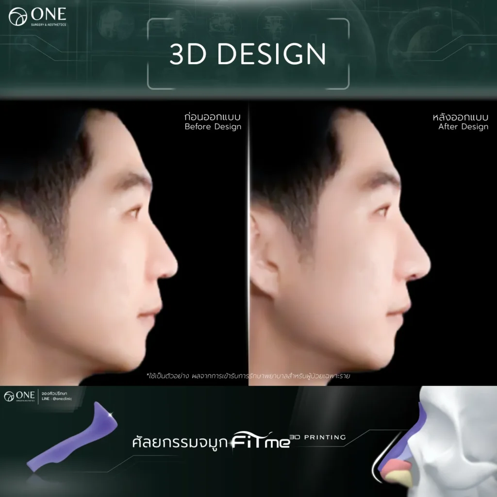 TemplateReview คุณแฟ้ม1