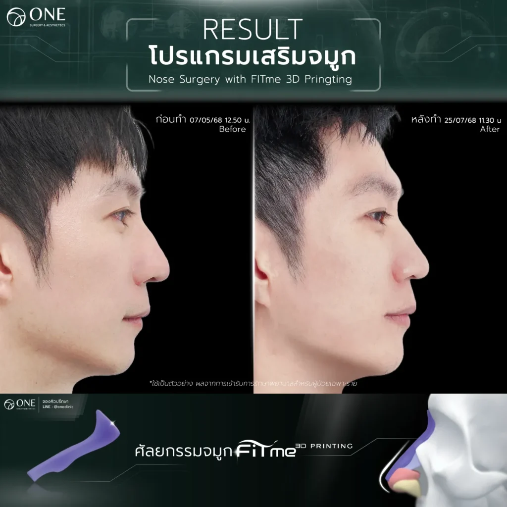 TemplateReview คุณแฟ้ม2