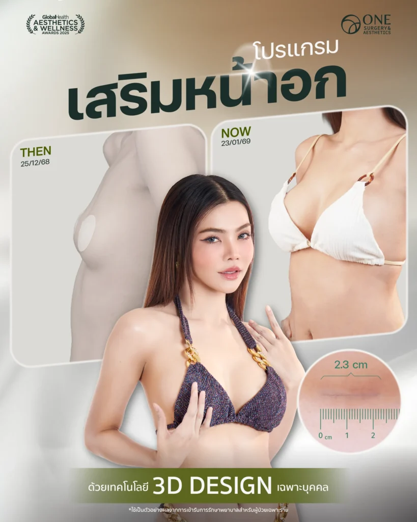 รวมรีวิวเสริมหน้าอก Final Web-01