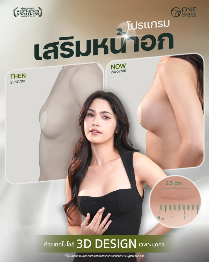 รวมรีวิวเสริมหน้าอก Final Web-04