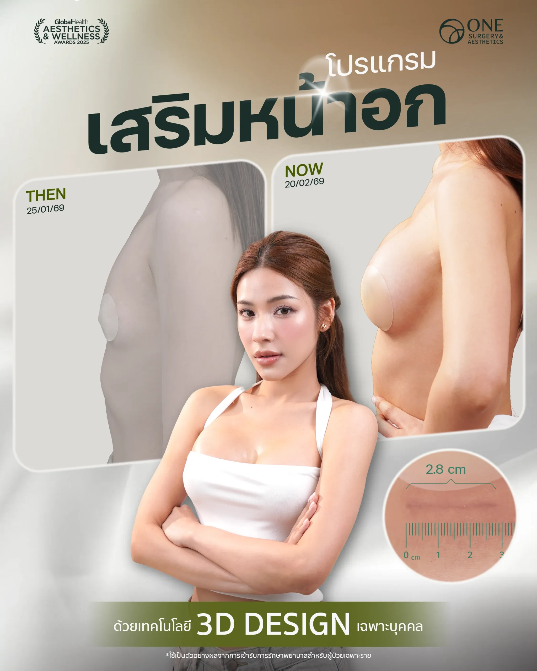 รวมรีวิวเสริมหน้าอก Final Web-05