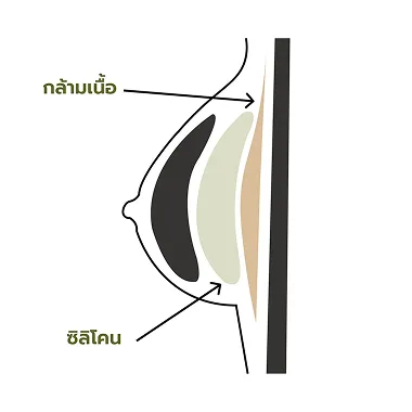 เหนือกล้ามเนื้อ