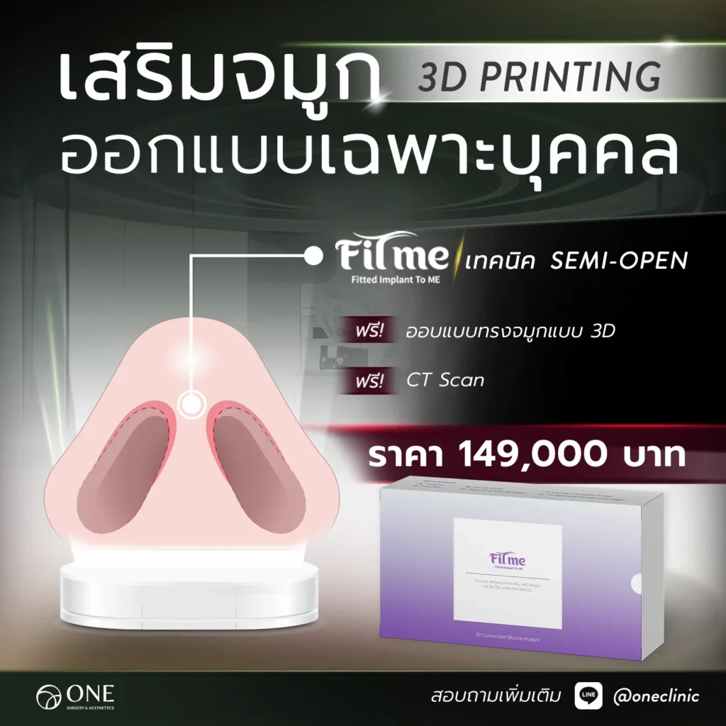 เสริมจมูก