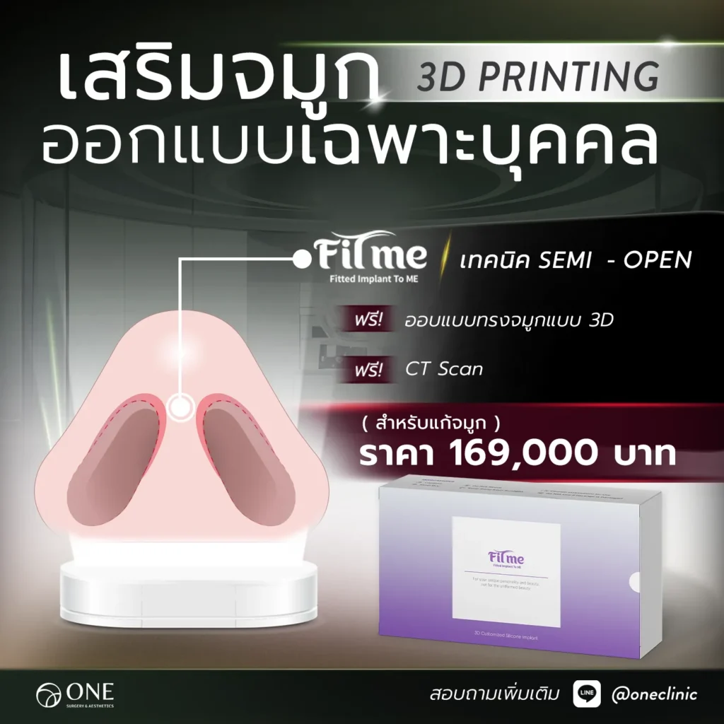 เสริมจมูก