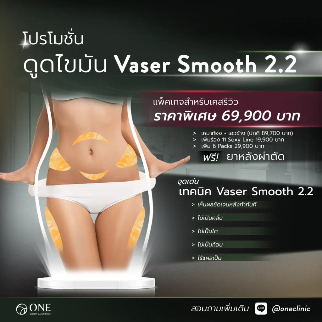 ดูดไขมัน