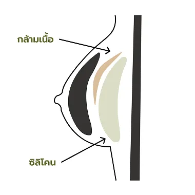 ใต้กล้ามเนื้อบางส่วน
