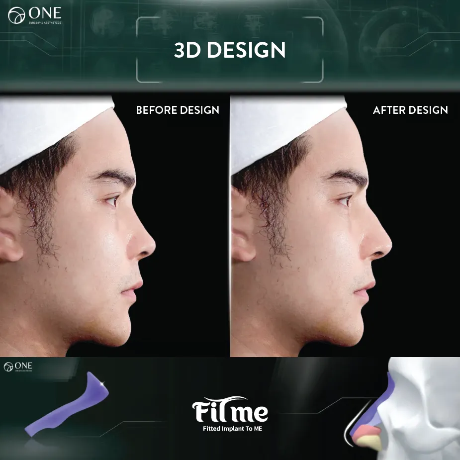 01 FITme 3D Printing-02