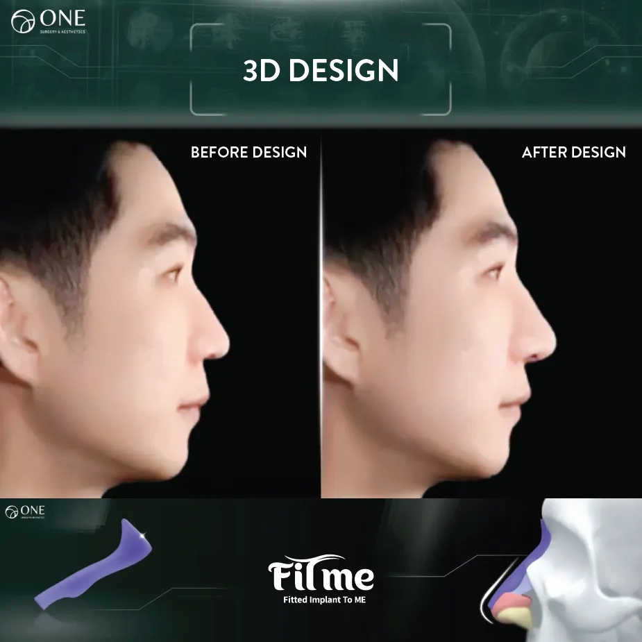 01 FITme 3D Printing-05