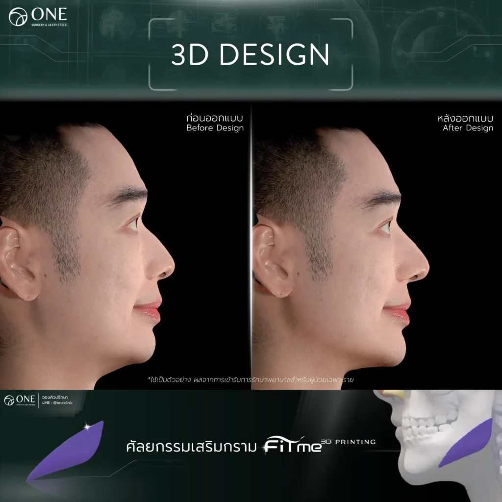 TemplateReview 1_11zon