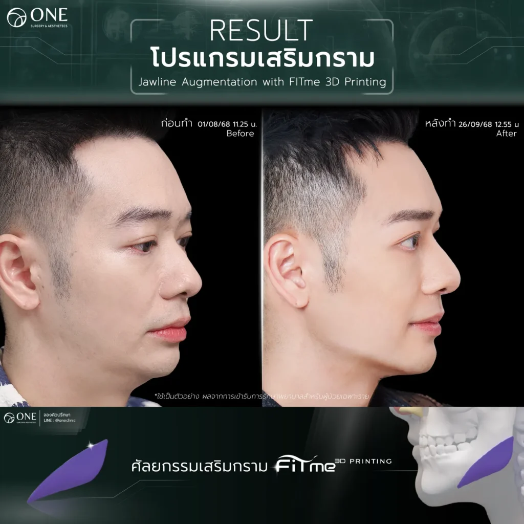 TemplateReview 2_11zon