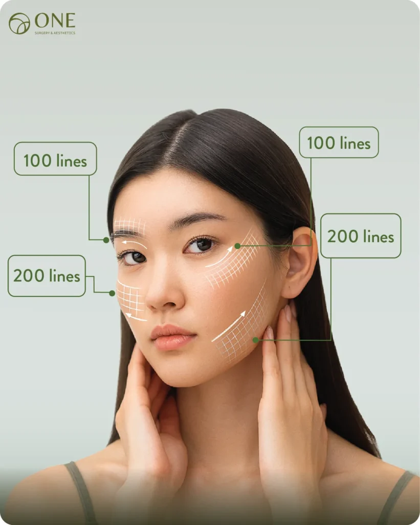 AW Ultraformer MPT-03