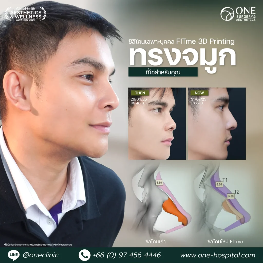 1 แทมเพลลตรีวิวจมูก_พี่เบิร์ต