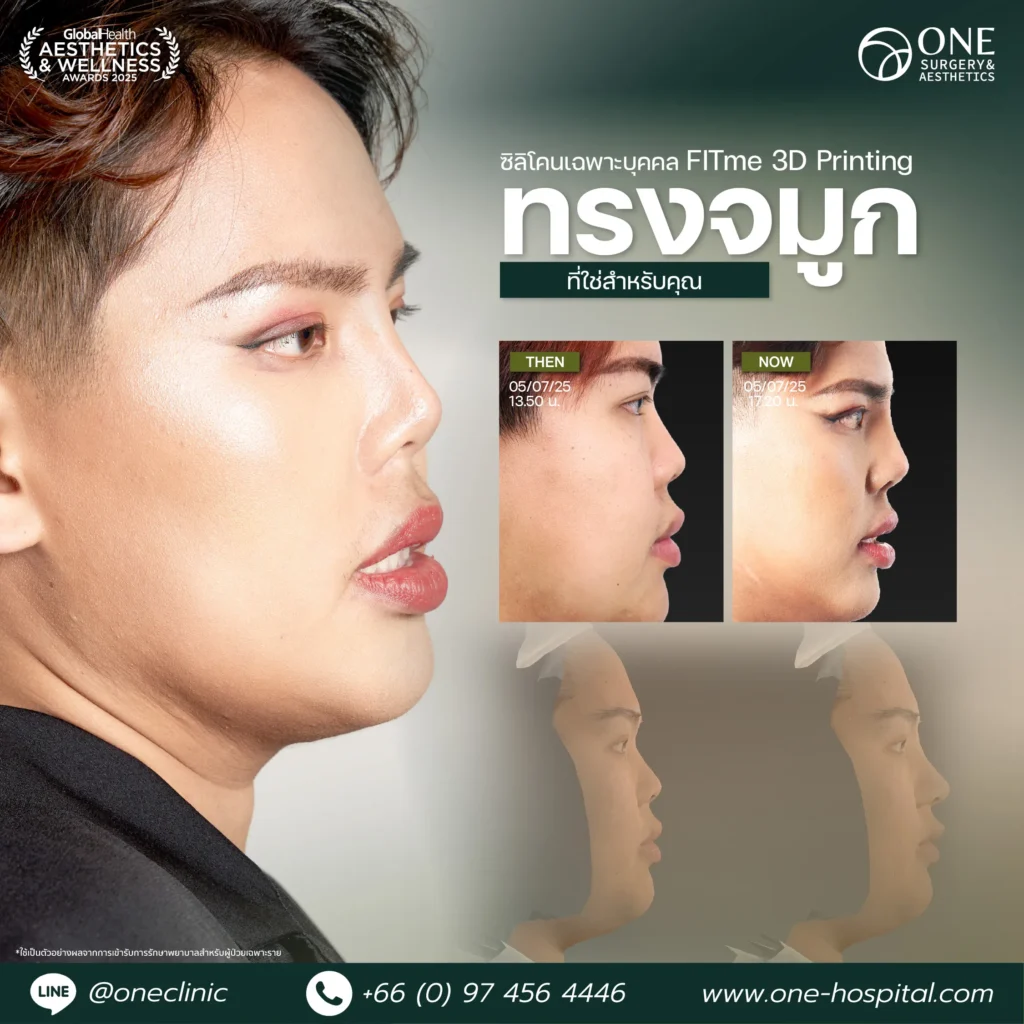 1 แทมเพลลตรีวิวจมูก_มาเบล