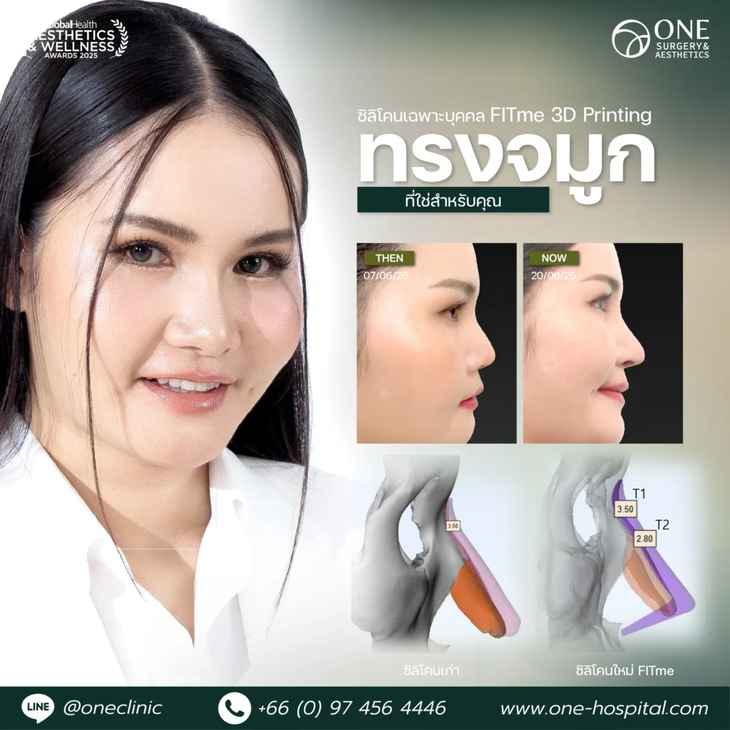 1 แทมเพลลตรีวิวจมูก_อาย