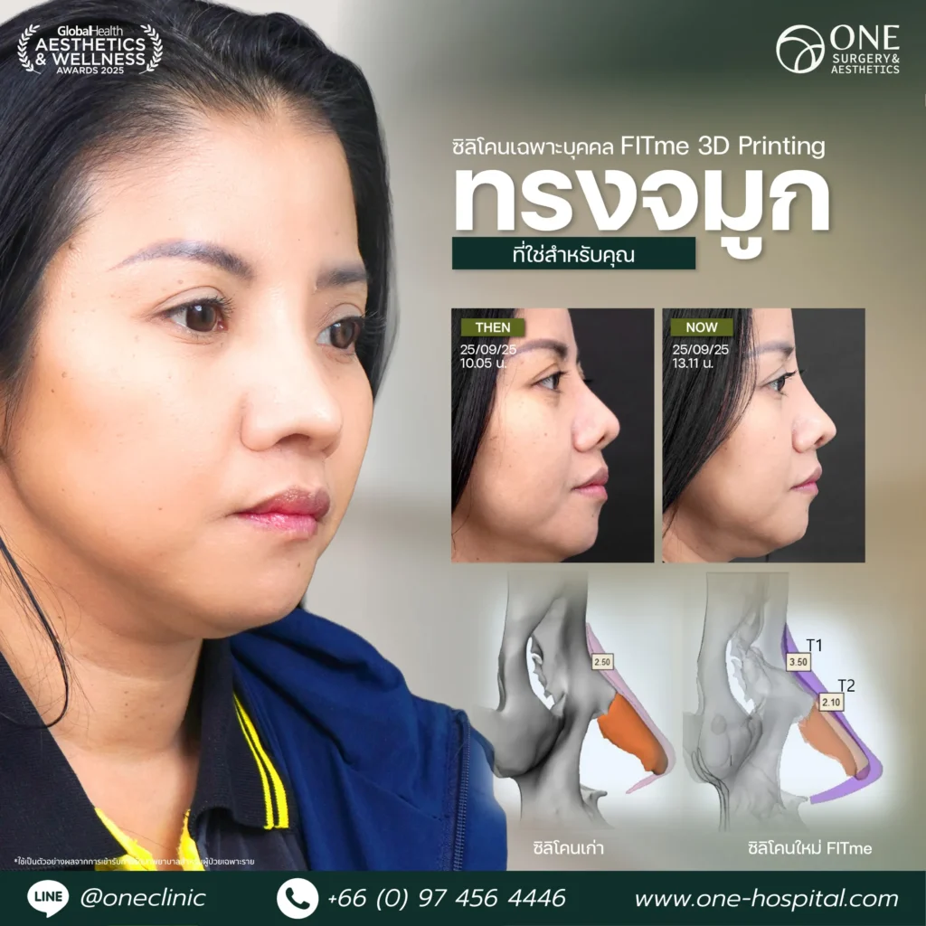 2แทมเพลลตรีวิวจมูก_ป็อก