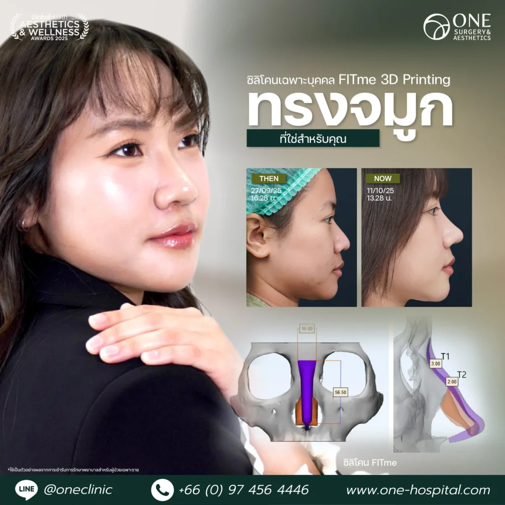 2แทมเพลลตรีวิวจมูก_พุธิตา