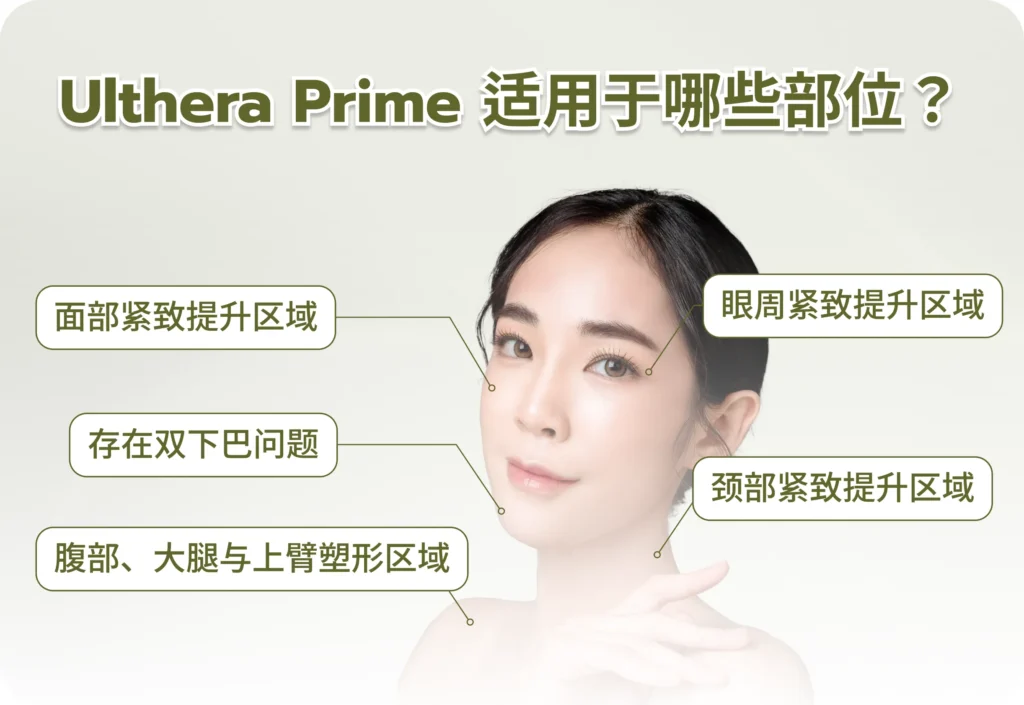 Ulthera Prime ทำจุดไหนได้บ้าง CN