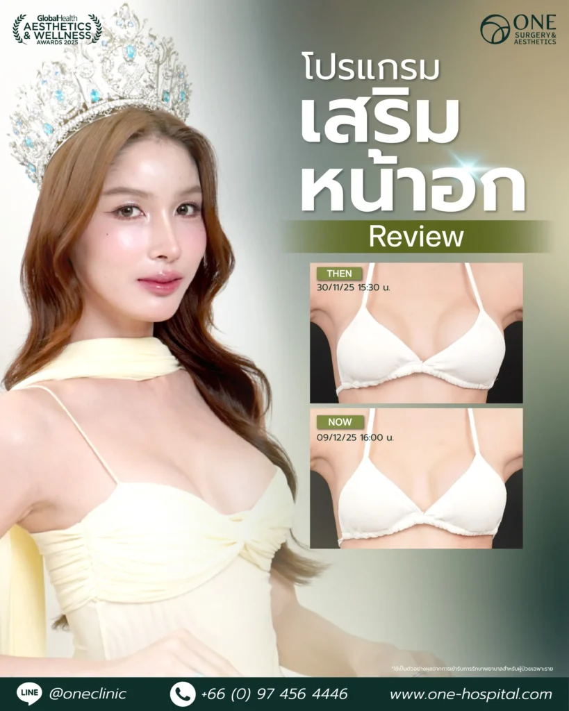 รีวิวนม-01