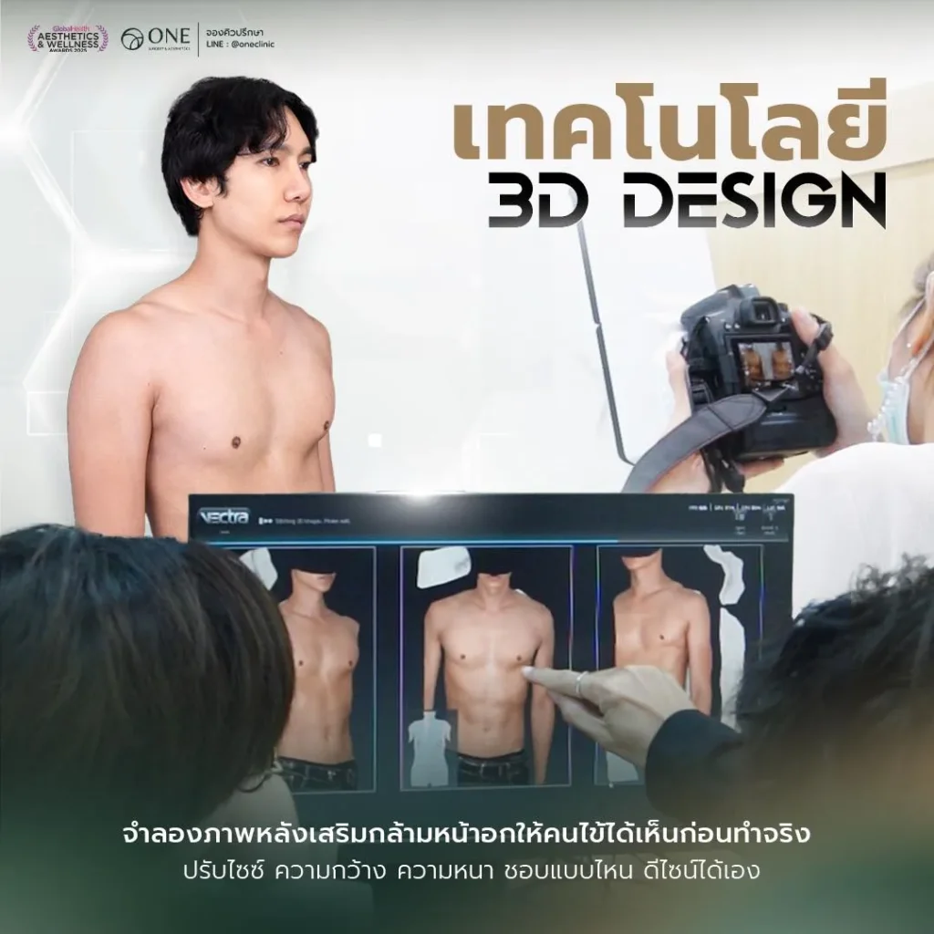 เสริมกล้ามอก