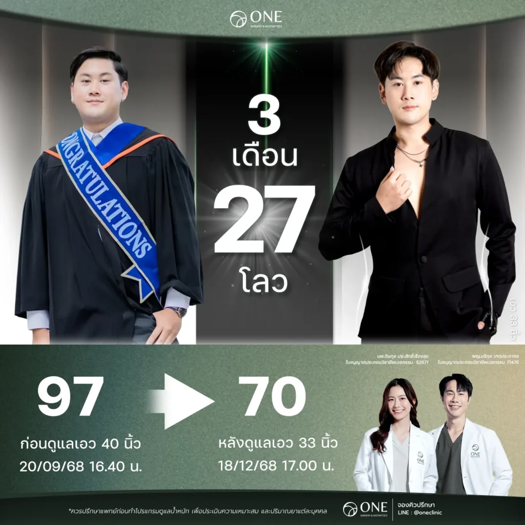 ปากกาลดน้ำหนัก