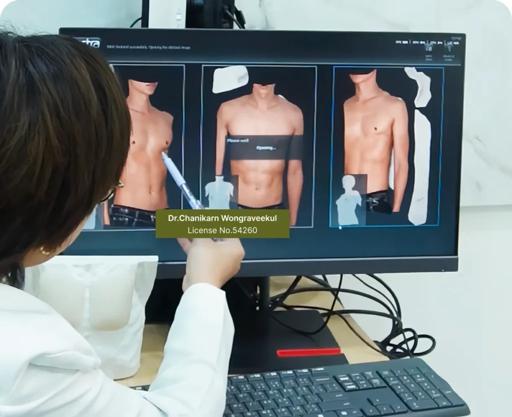 เสริมกล้ามอก