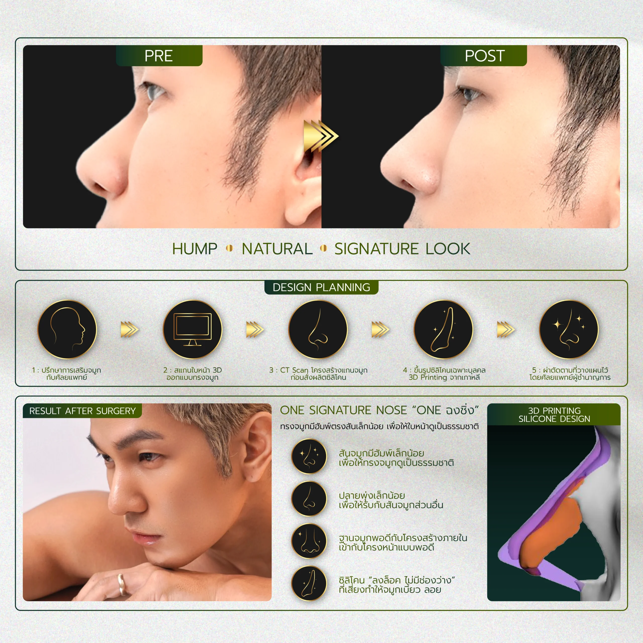 INFO รวมจมูก Website-01_32